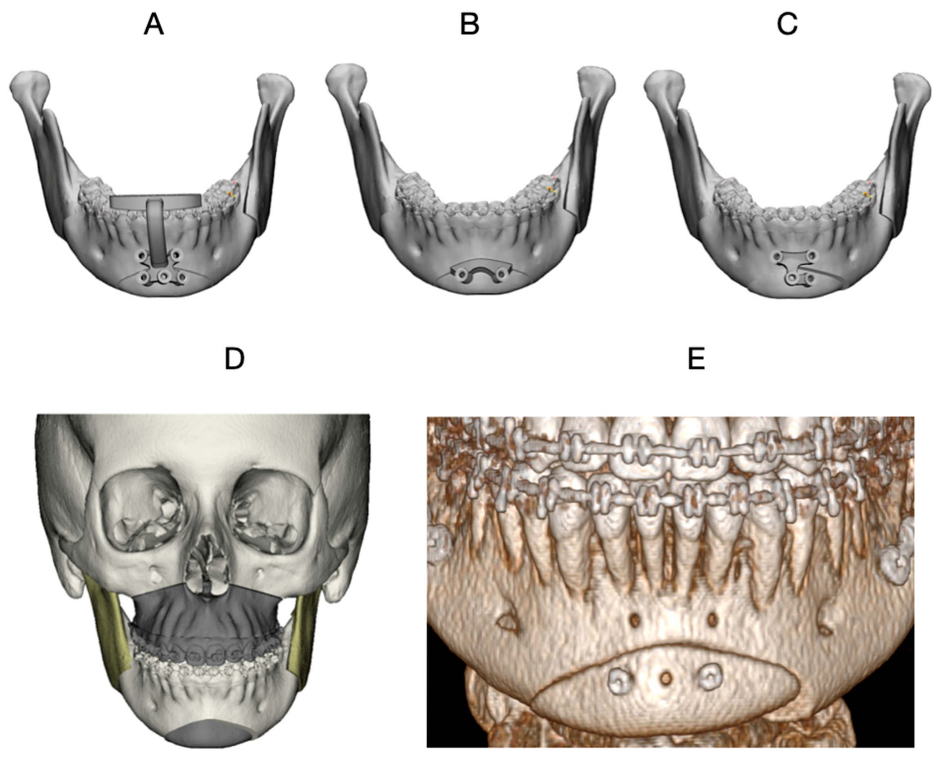Dentistry 14 00135 g004 Dentistry 14 00135 g004