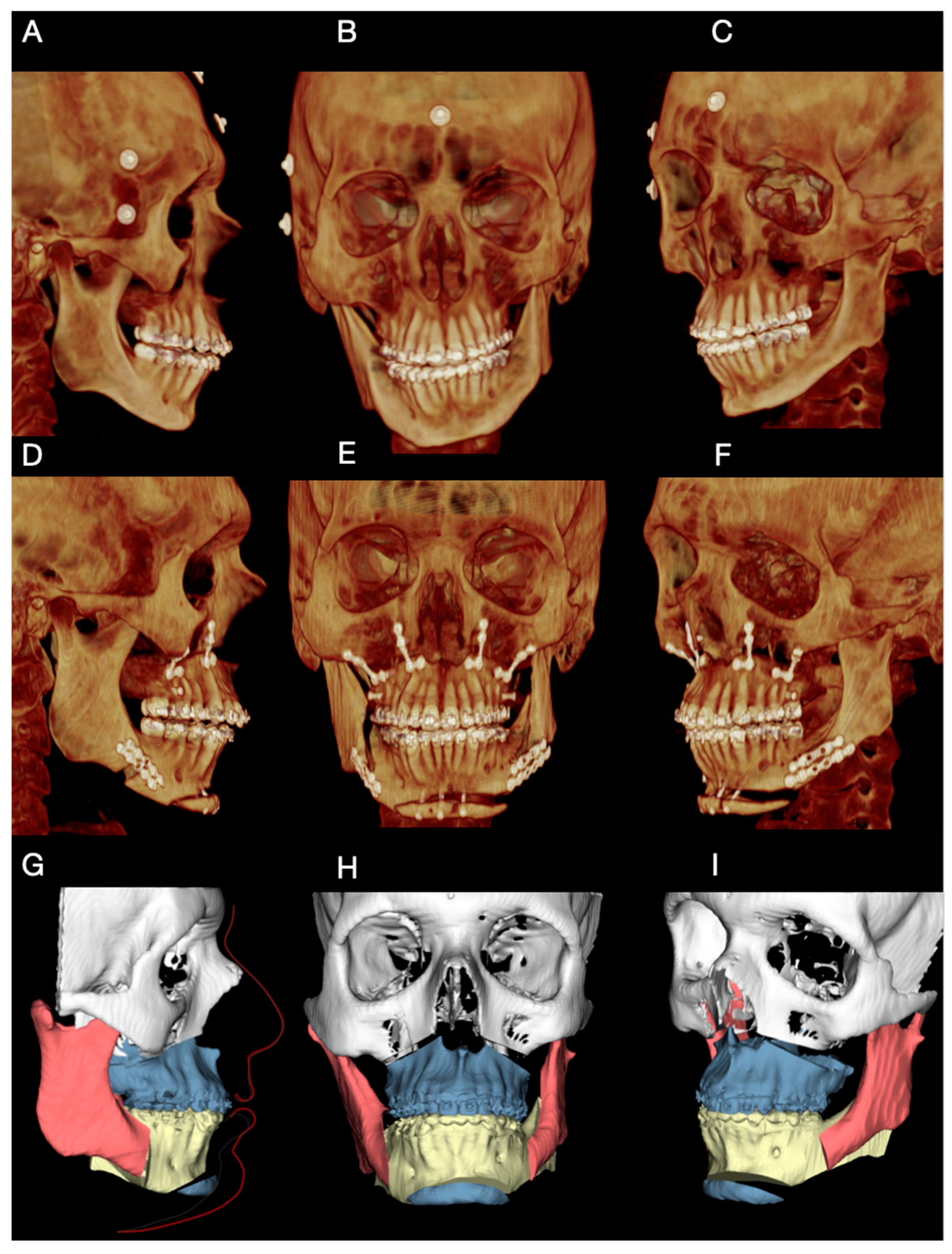 Dentistry 14 00135 g005 Dentistry 14 00135 g005