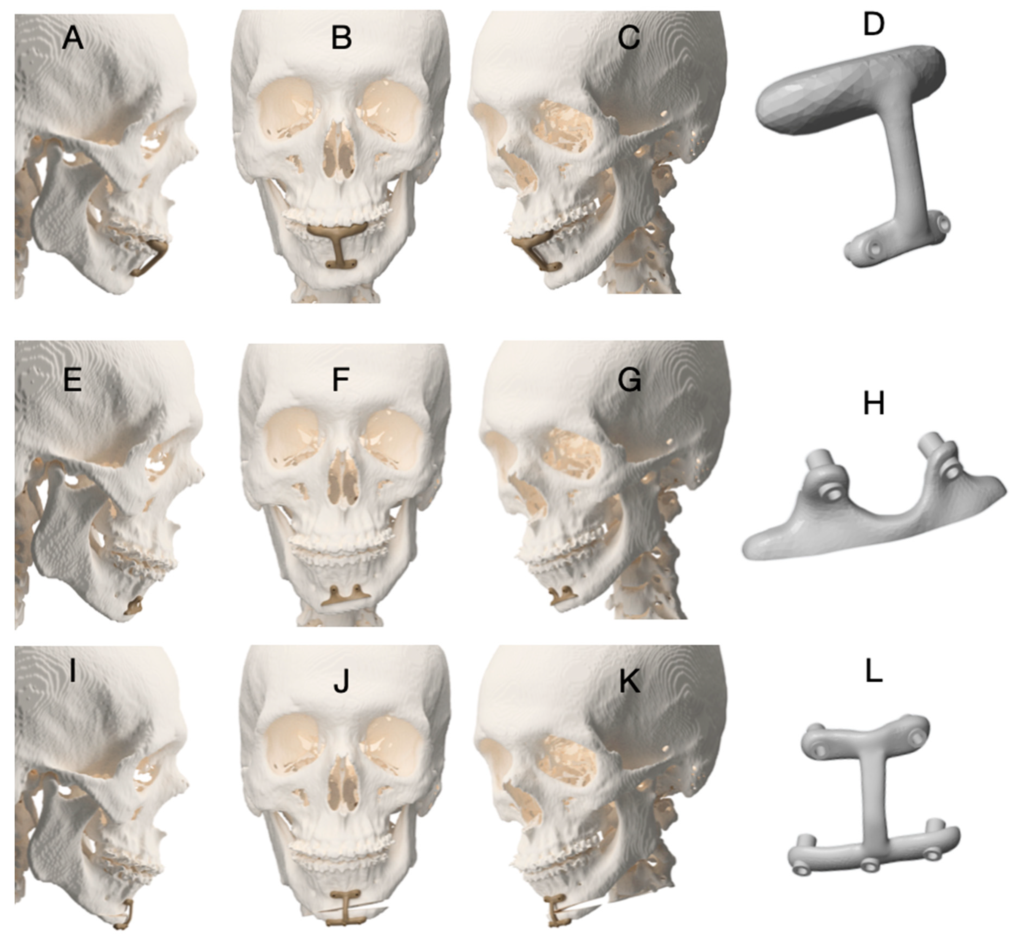 Dentistry 14 00135 g006 Dentistry 14 00135 g006