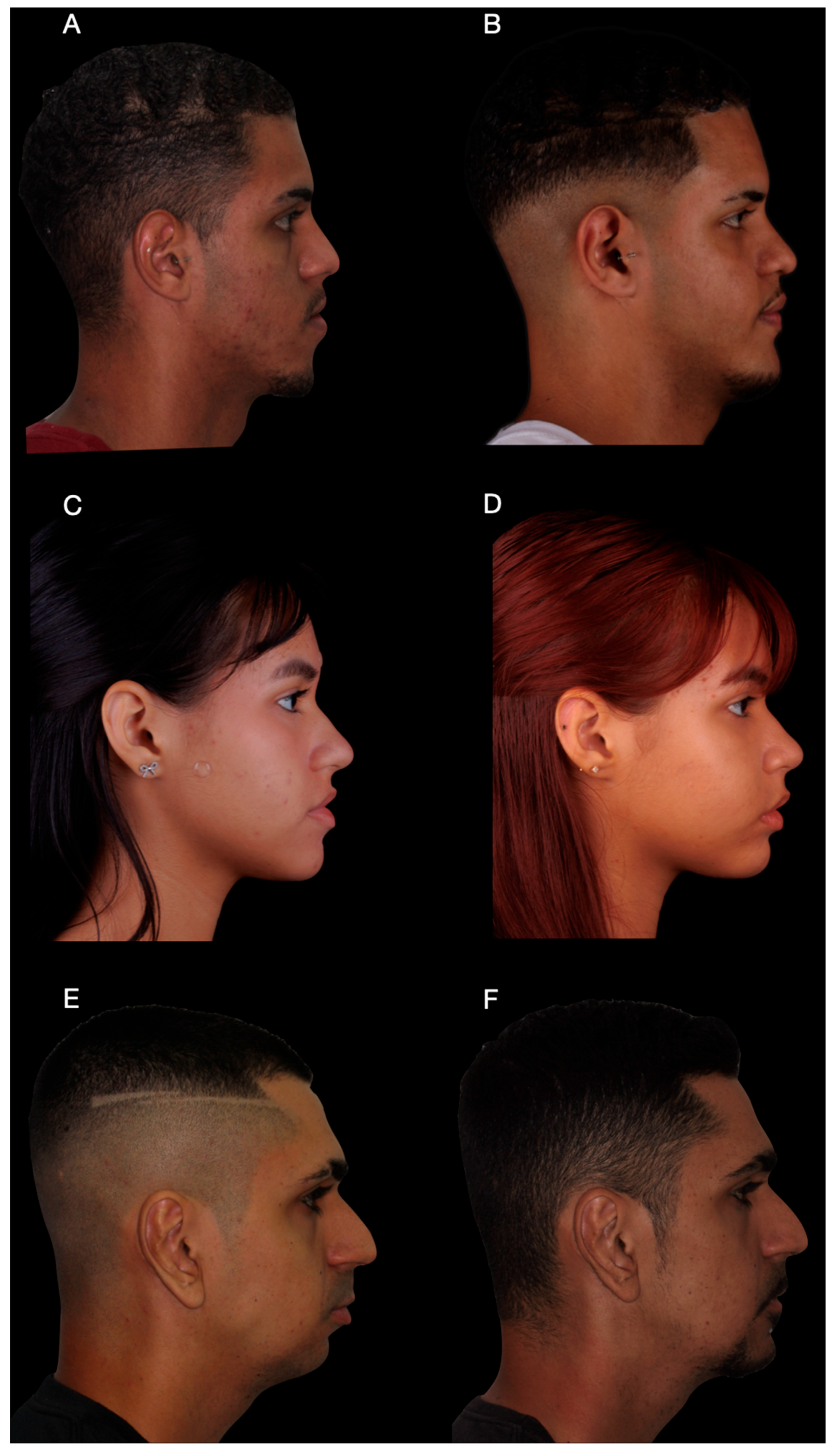 Dentistry 14 00135 g008 Dentistry 14 00135 g008