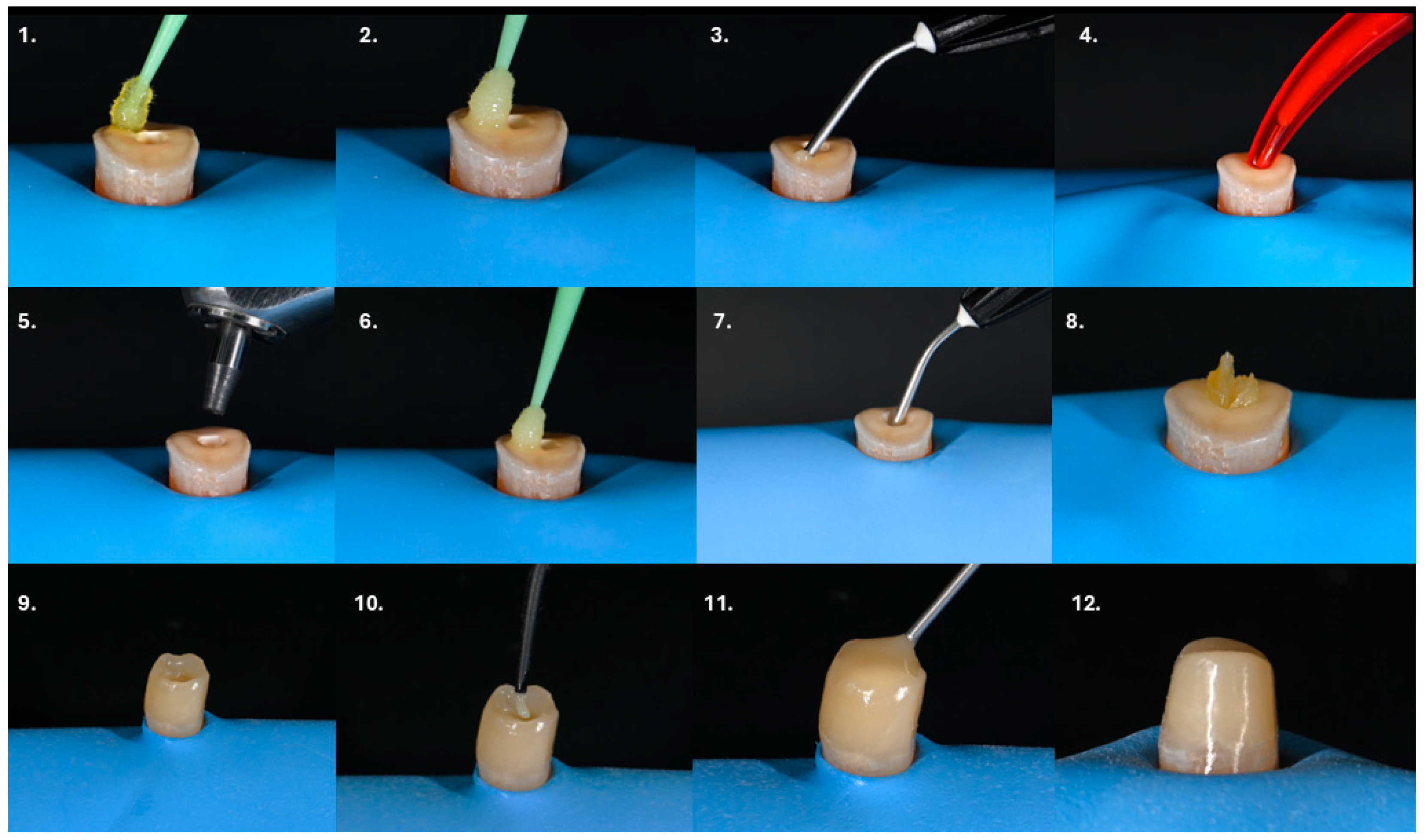 Dentistry 14 00136 g001