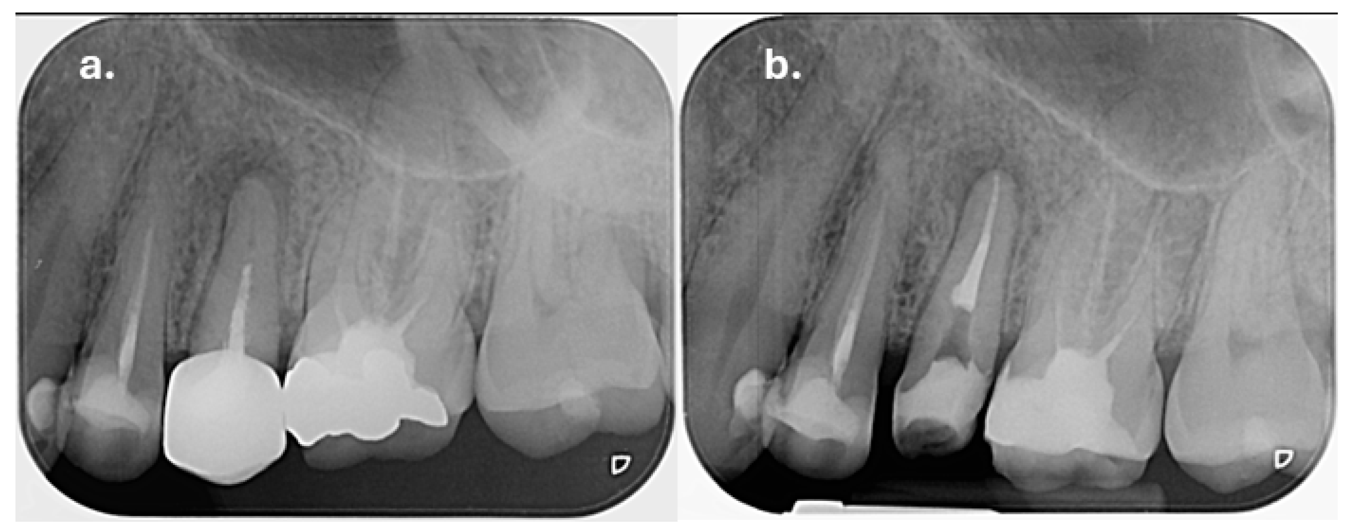 Dentistry 14 00136 g002