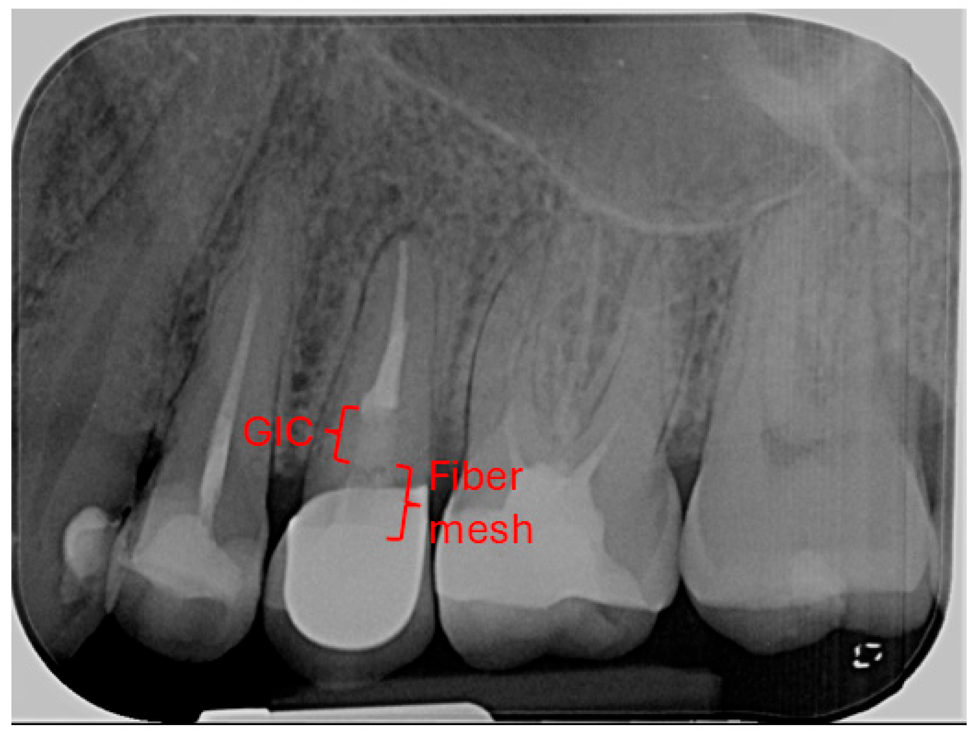 Dentistry 14 00136 g004