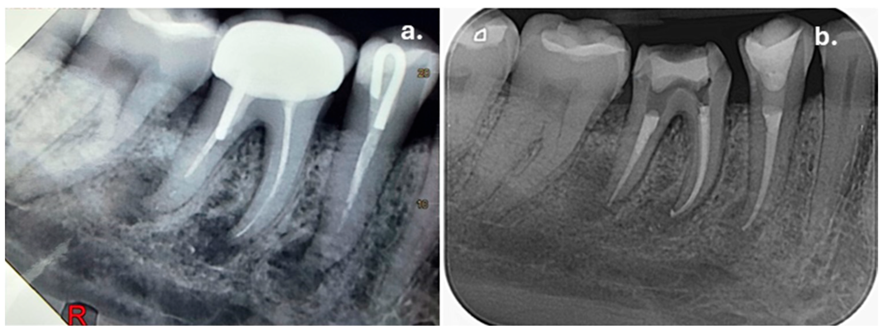 Dentistry 14 00136 g005