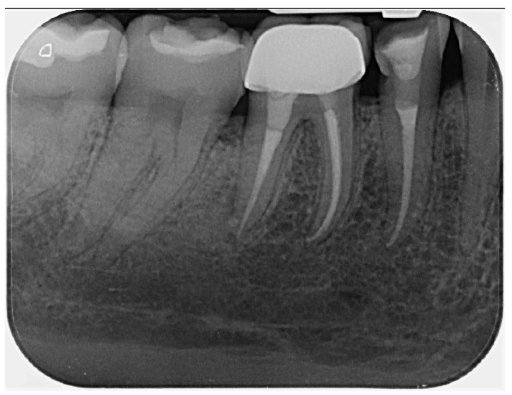 Dentistry 14 00136 g006