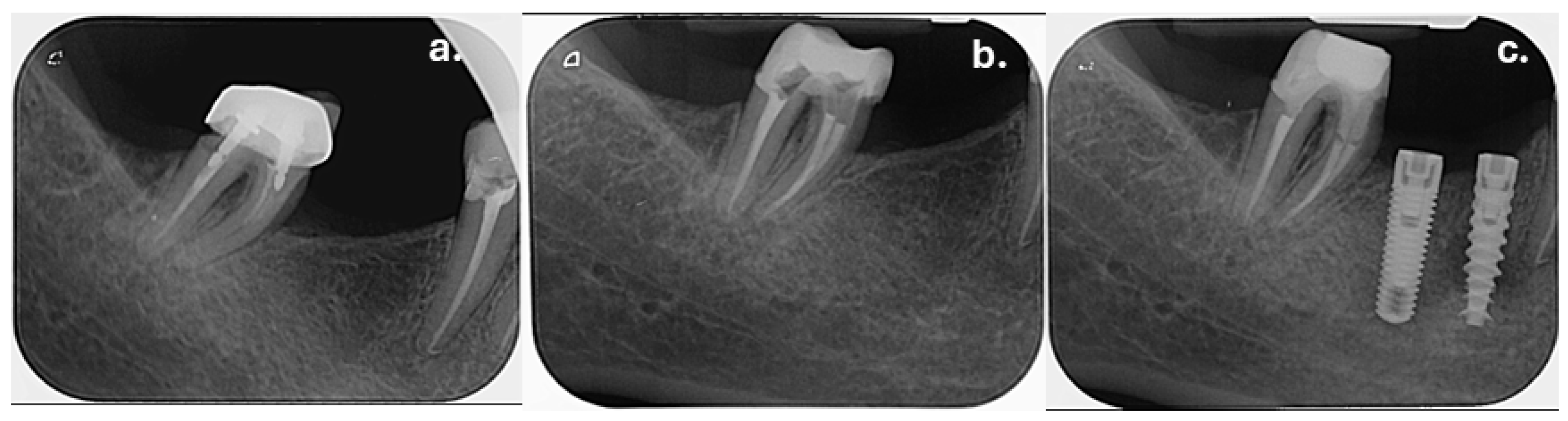 Dentistry 14 00136 g007