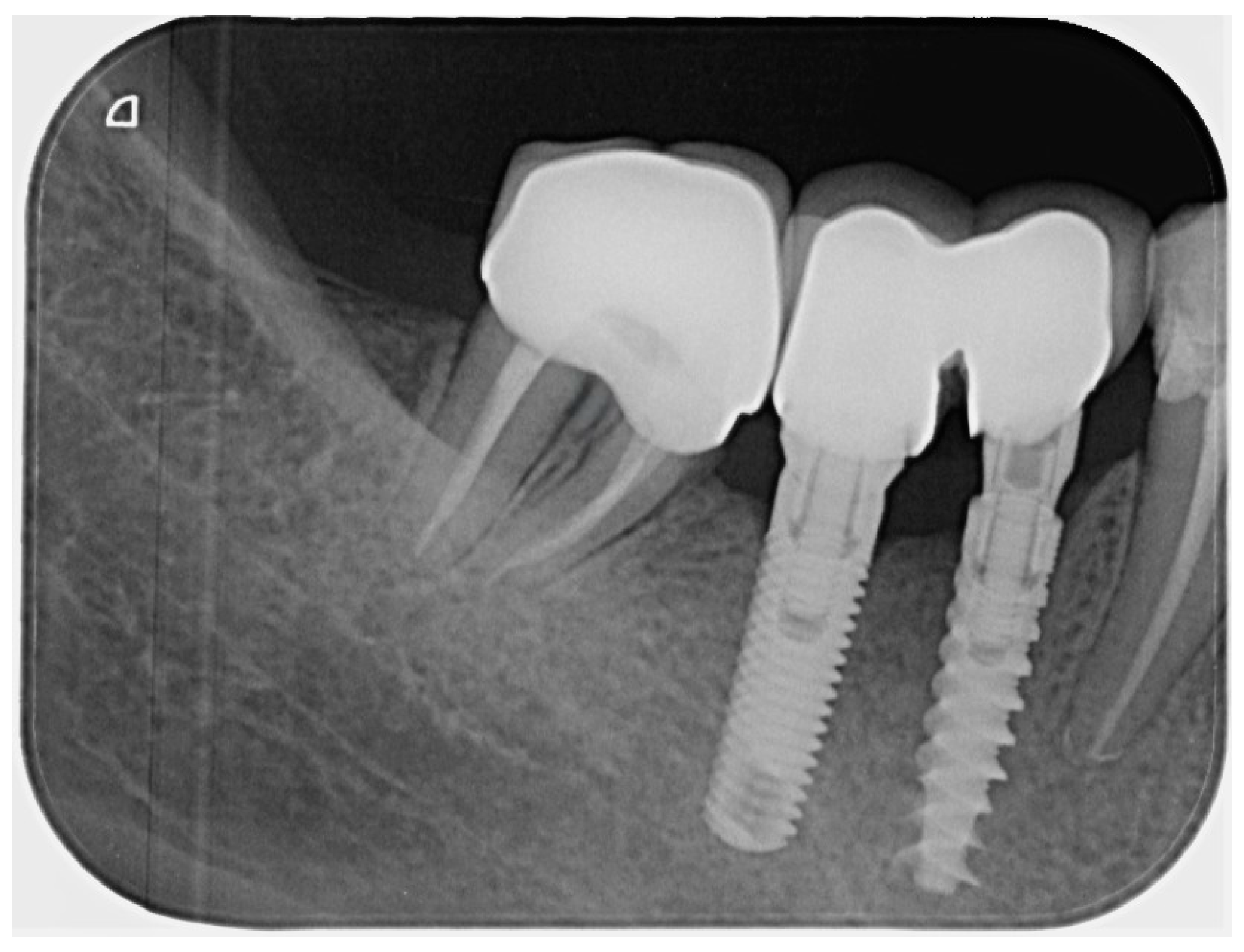 Dentistry 14 00136 g008