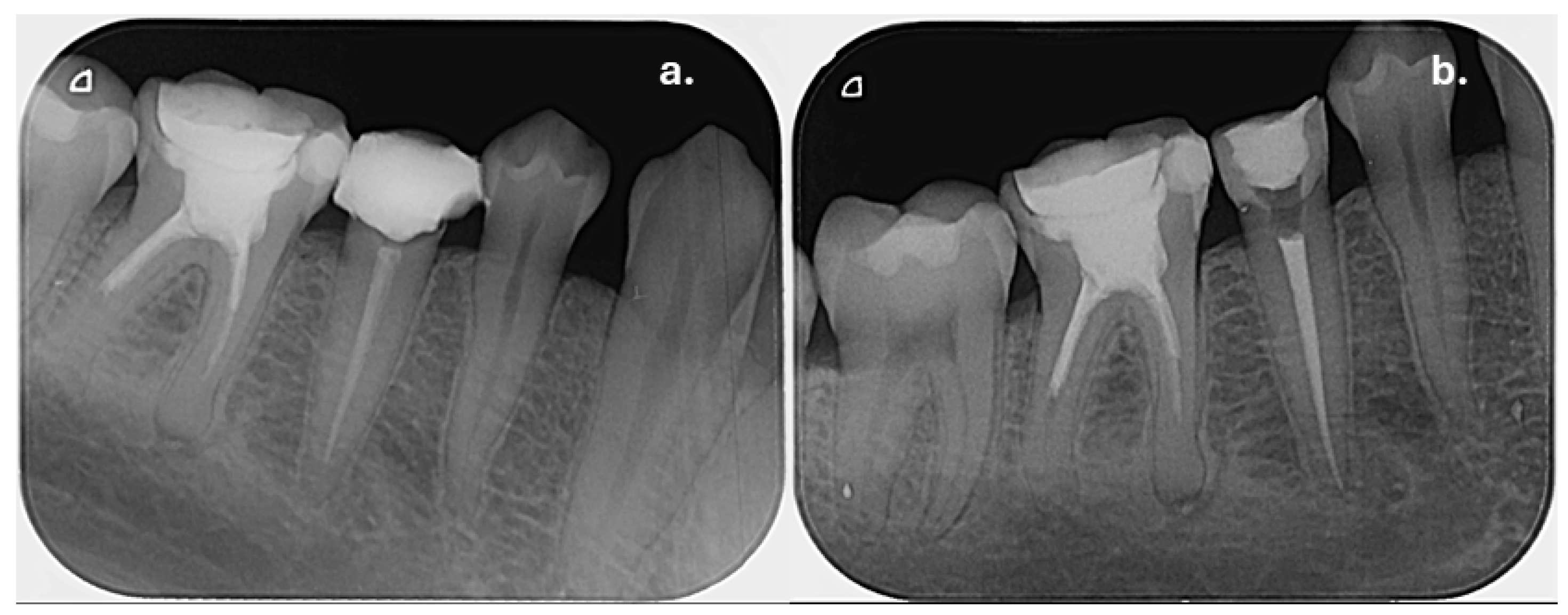 Dentistry 14 00136 g009