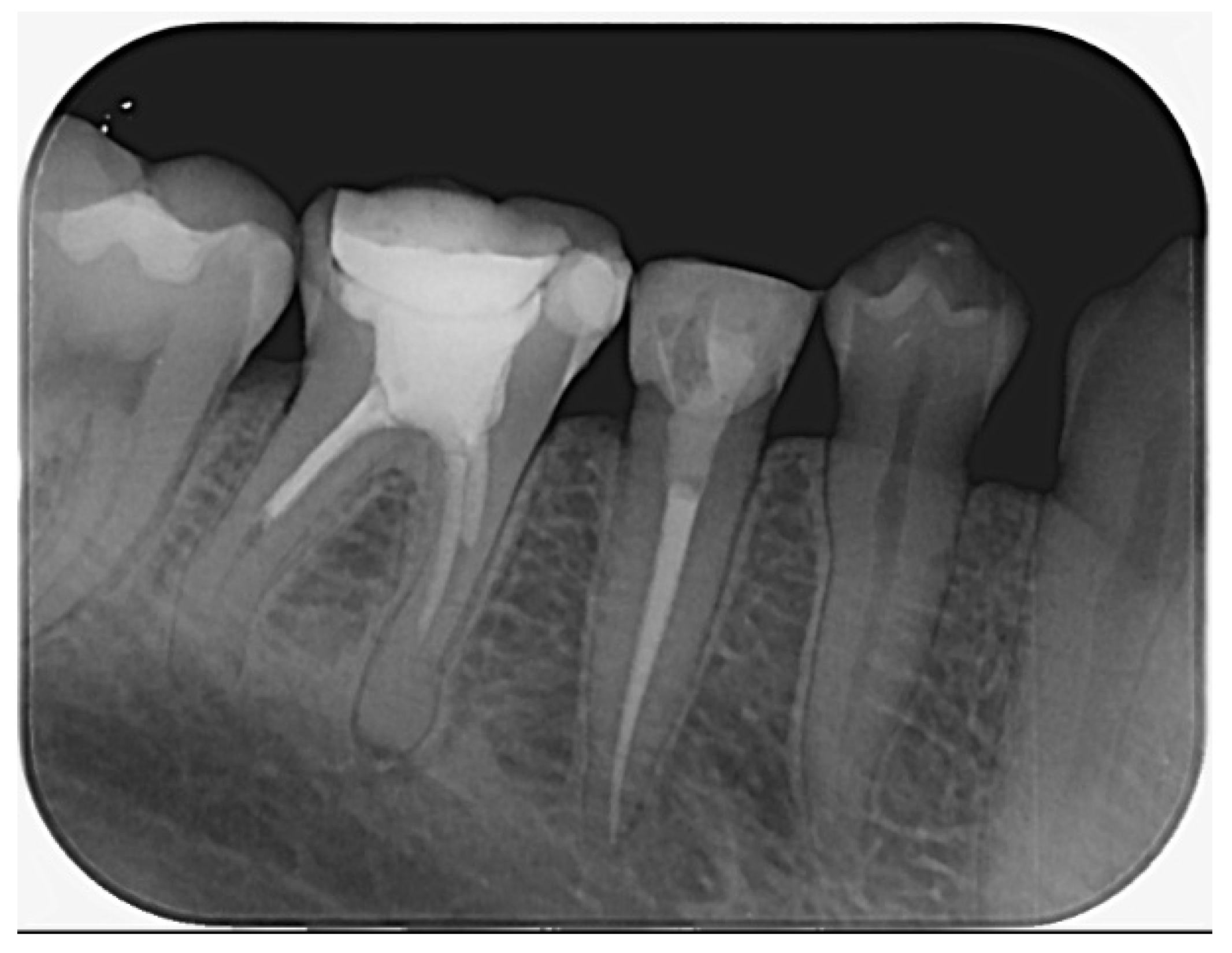 Dentistry 14 00136 g011