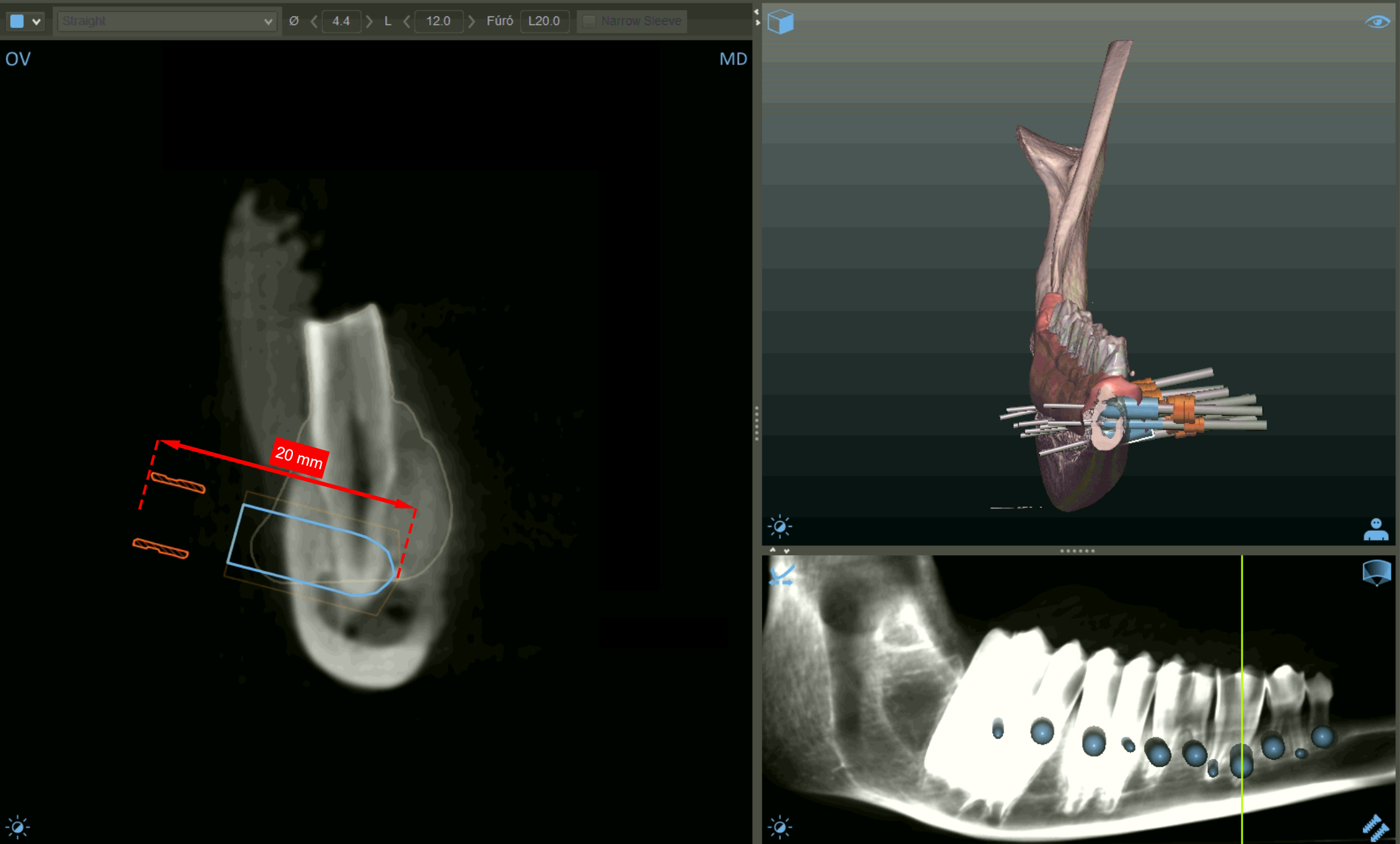 Dentistry 14 00155 g002 Dentistry 14 00155 g002