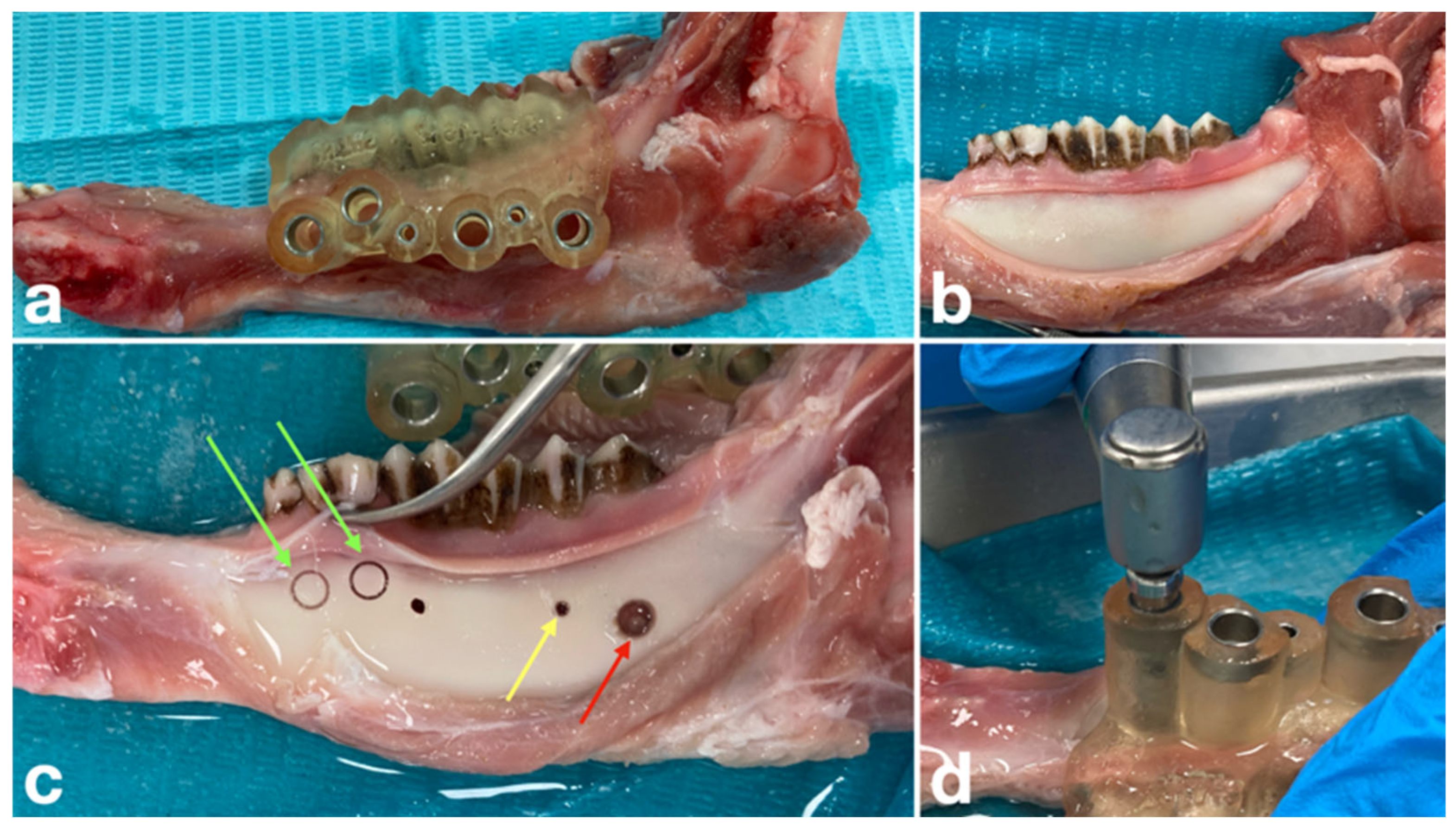 Dentistry 14 00155 g004 Dentistry 14 00155 g004