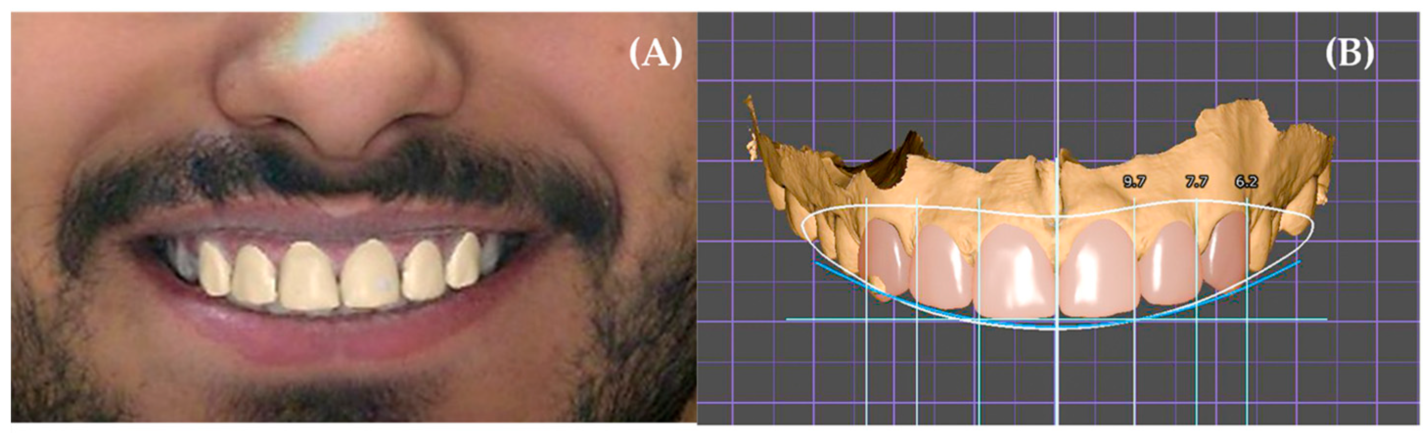 Dentistry 14 00166 g002
