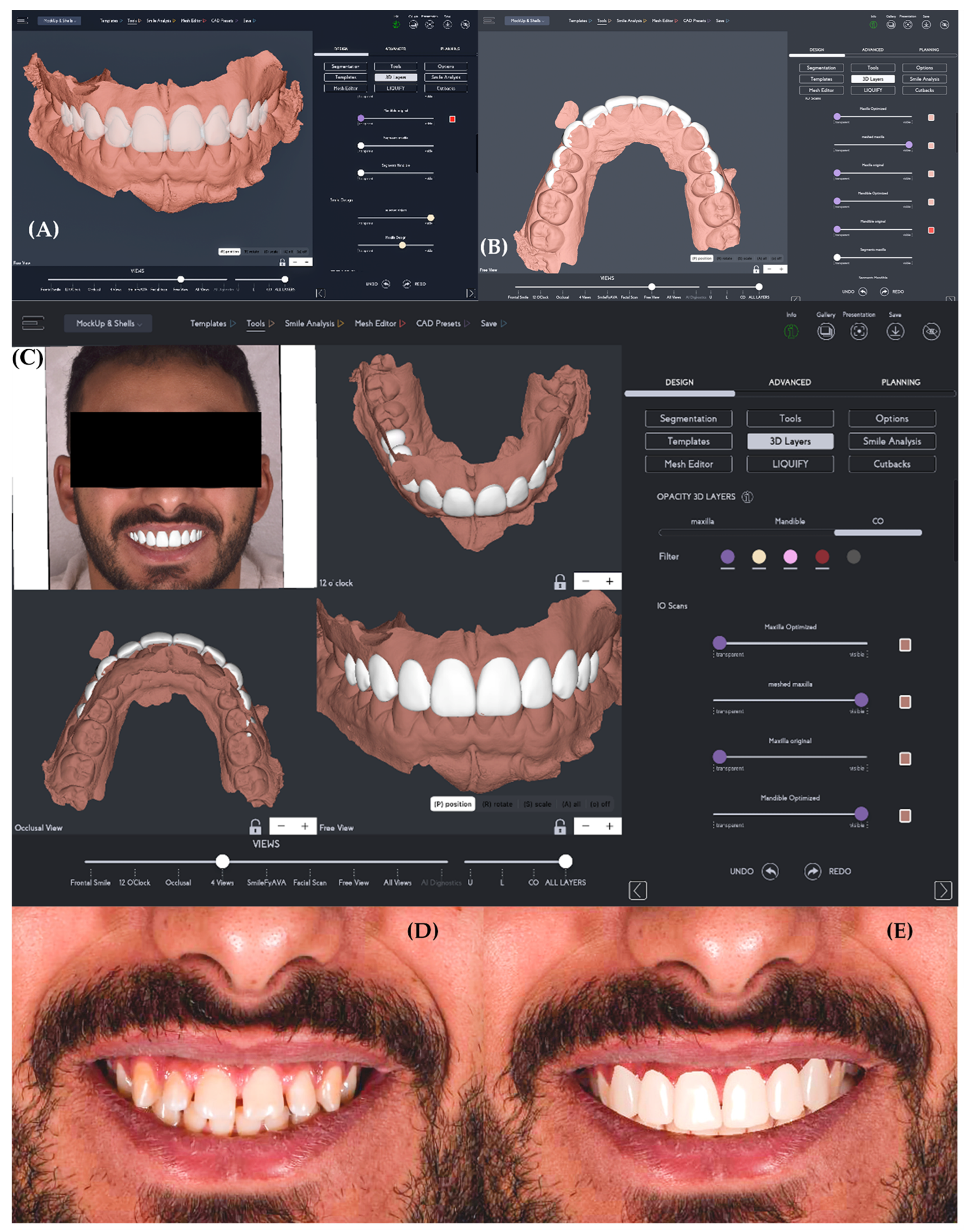 Dentistry 14 00166 g003