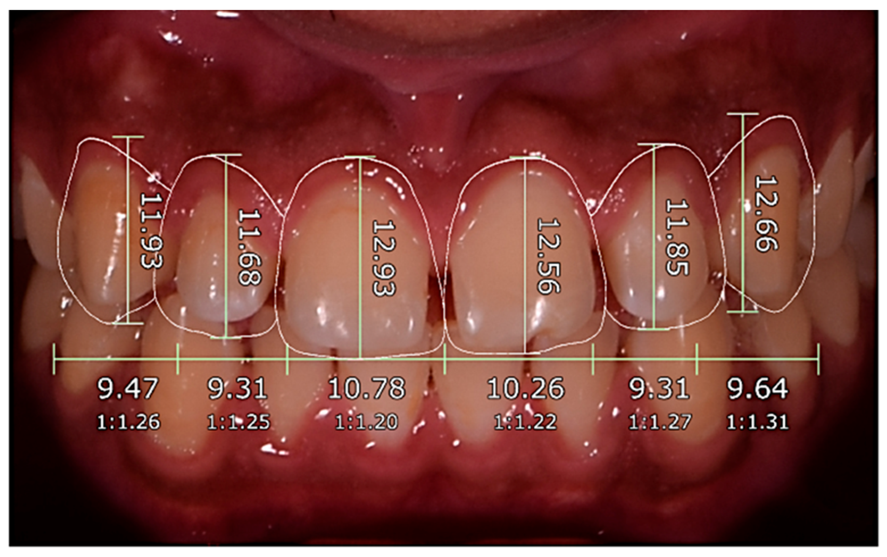 Dentistry 14 00166 g004