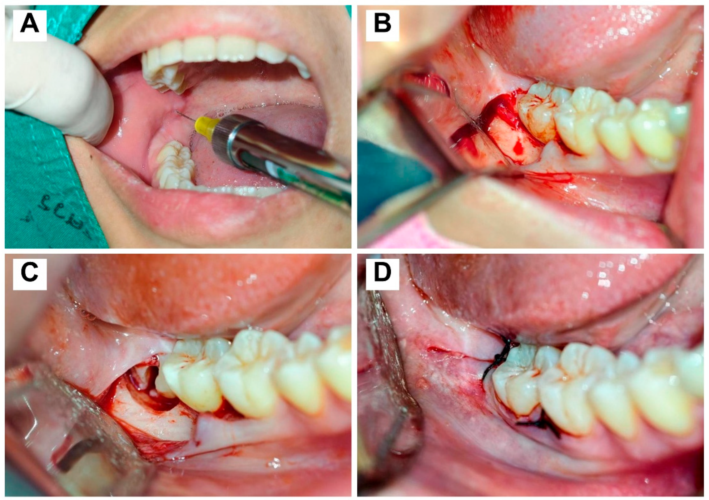 Dentistry 14 00183 g001 Dentistry 14 00183 g001