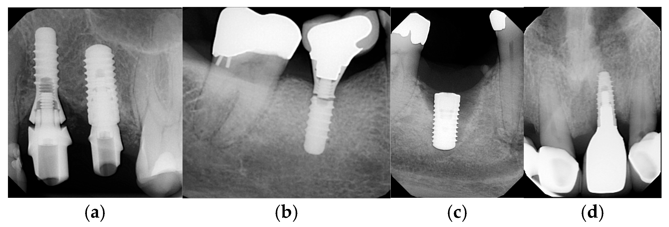 Dentistry 14 00185 g001 Dentistry 14 00185 g001