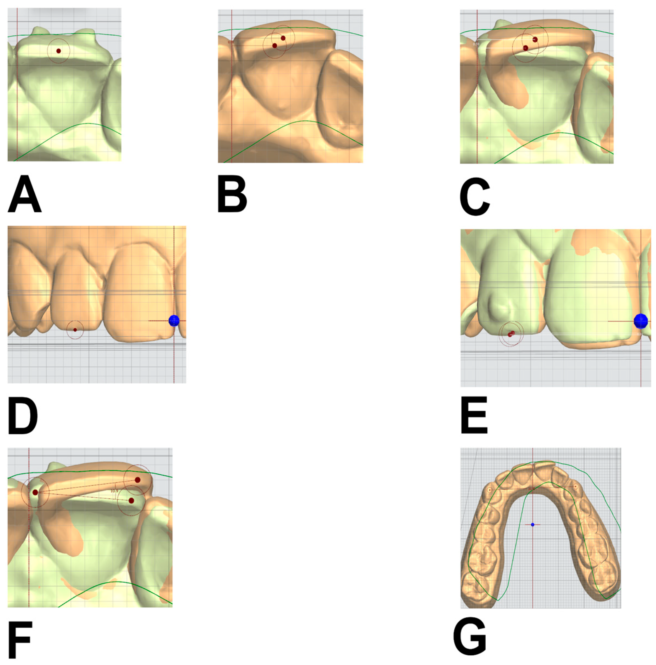 Dentistry 14 00240 g003 Dentistry 14 00240 g003