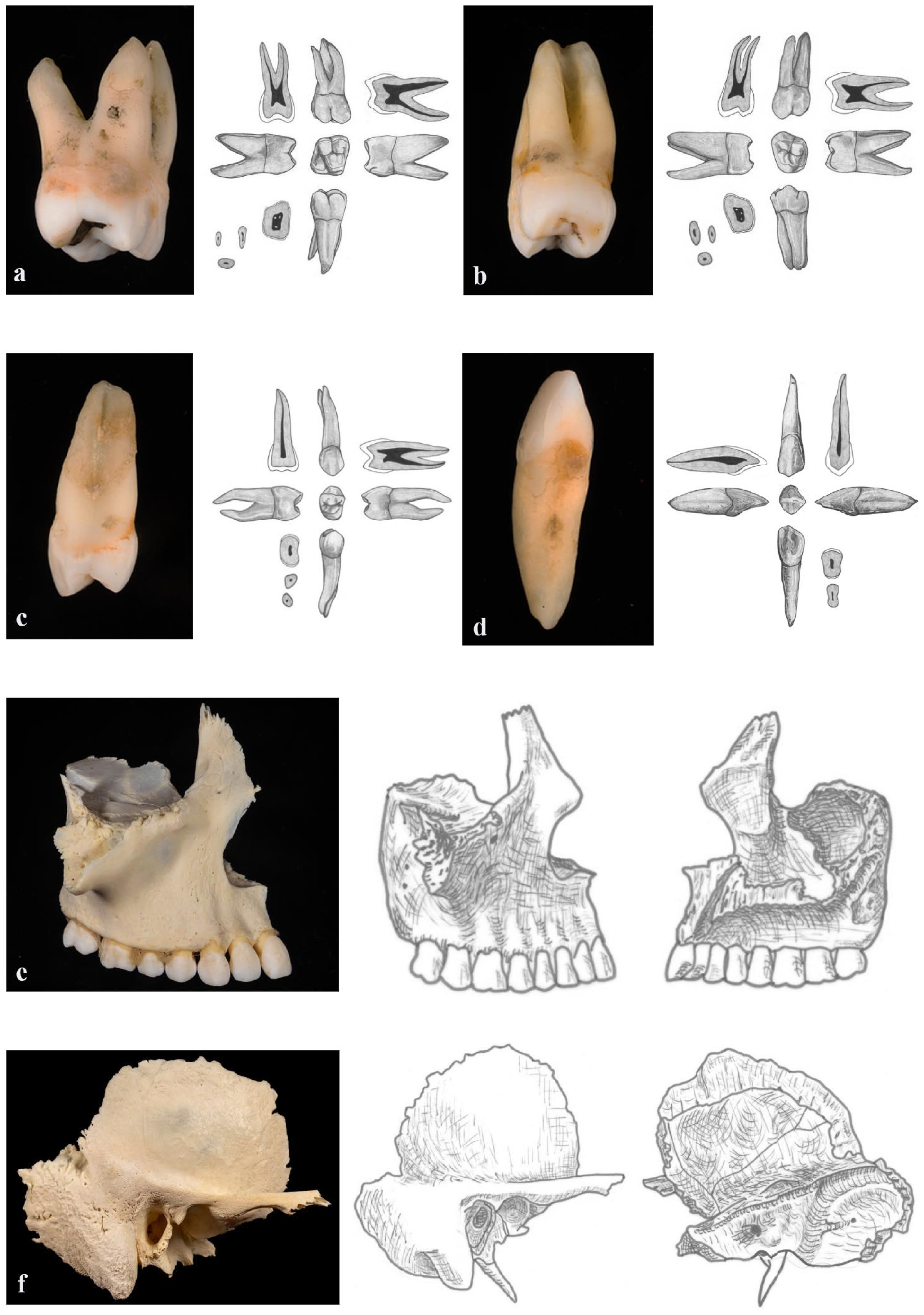 Dentistry 14 00245 g002 Dentistry 14 00245 g002