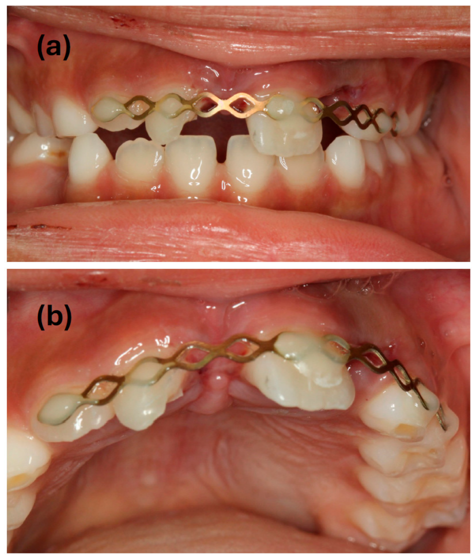 Dentistry 14 00275 g002 Dentistry 14 00275 g002