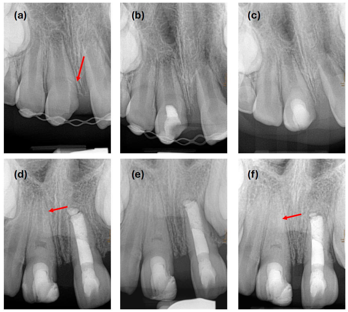 Dentistry 14 00275 g003 Dentistry 14 00275 g003