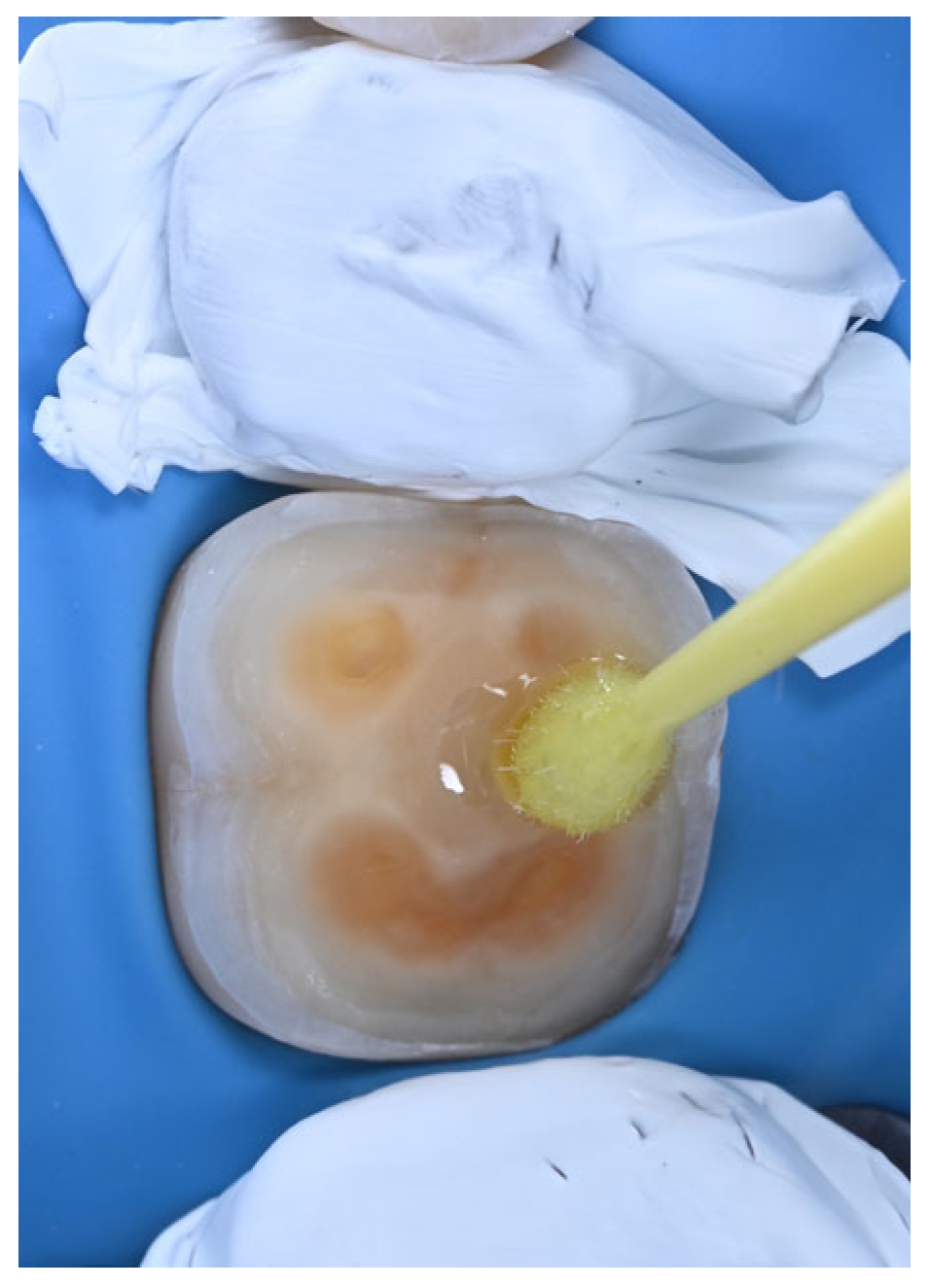 Dentistry 14 00281 g005 Dentistry 14 00281 g005