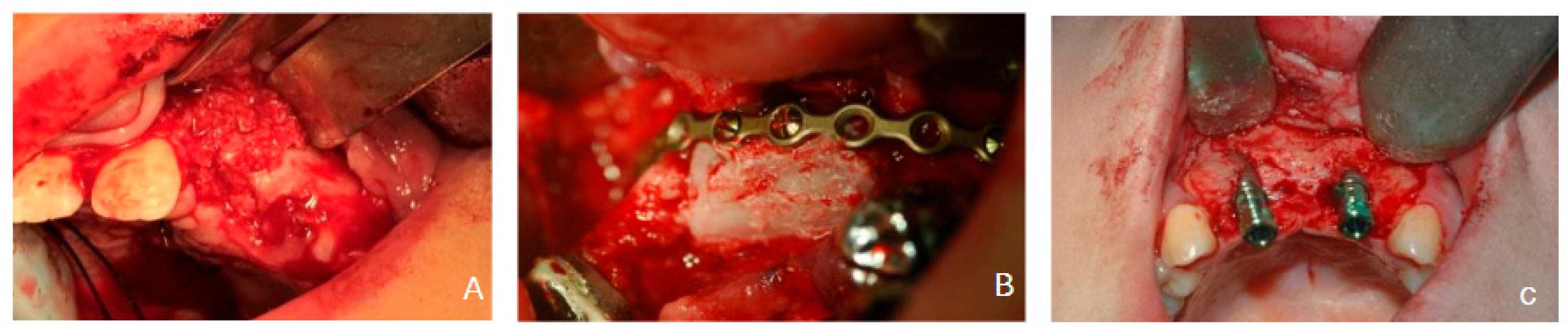 Dentistry 14 00287 g001 Dentistry 14 00287 g001