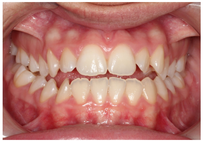 Dentistry 14 00288 g001 Dentistry 14 00288 g001