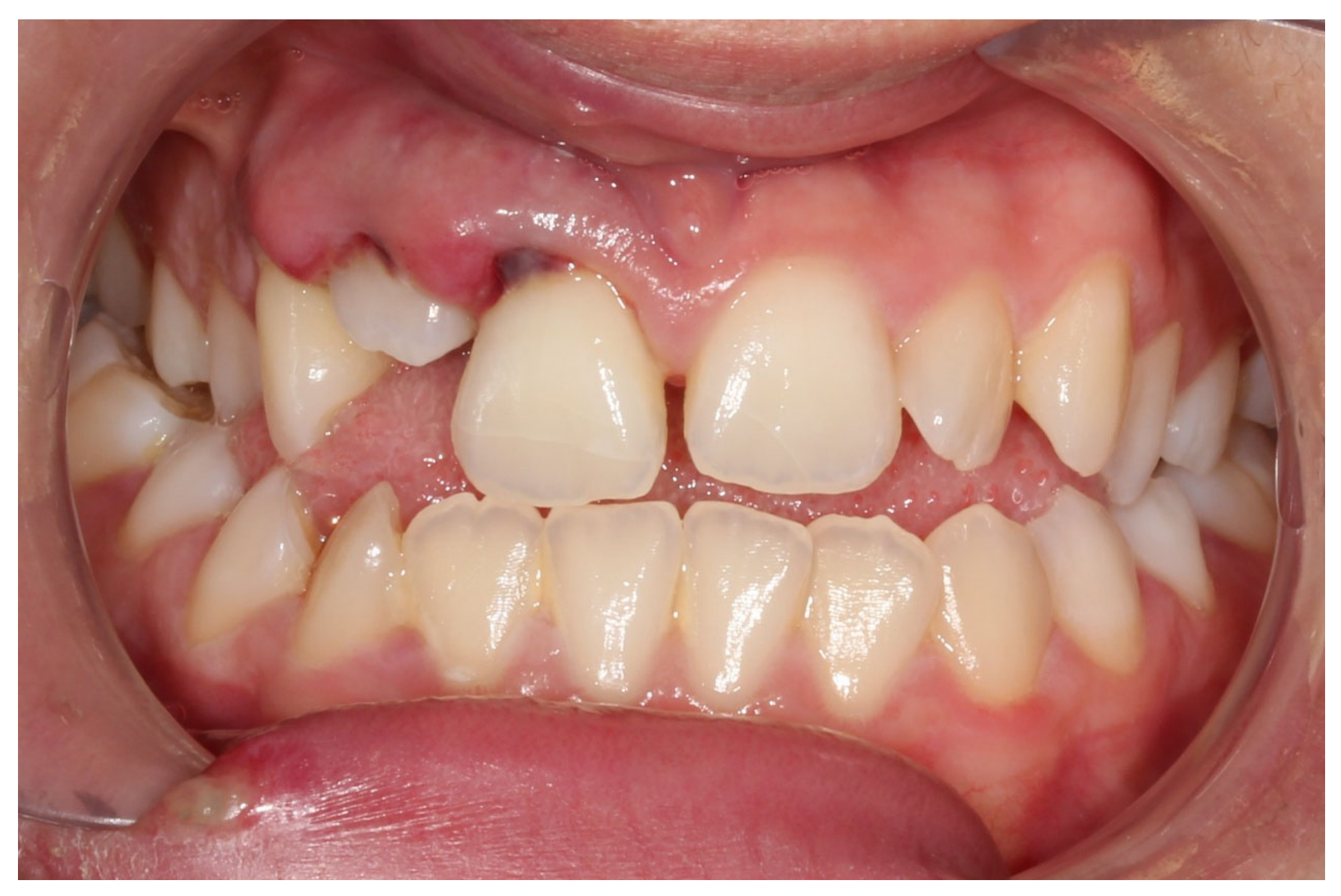 Dentistry 14 00288 g002 Dentistry 14 00288 g002