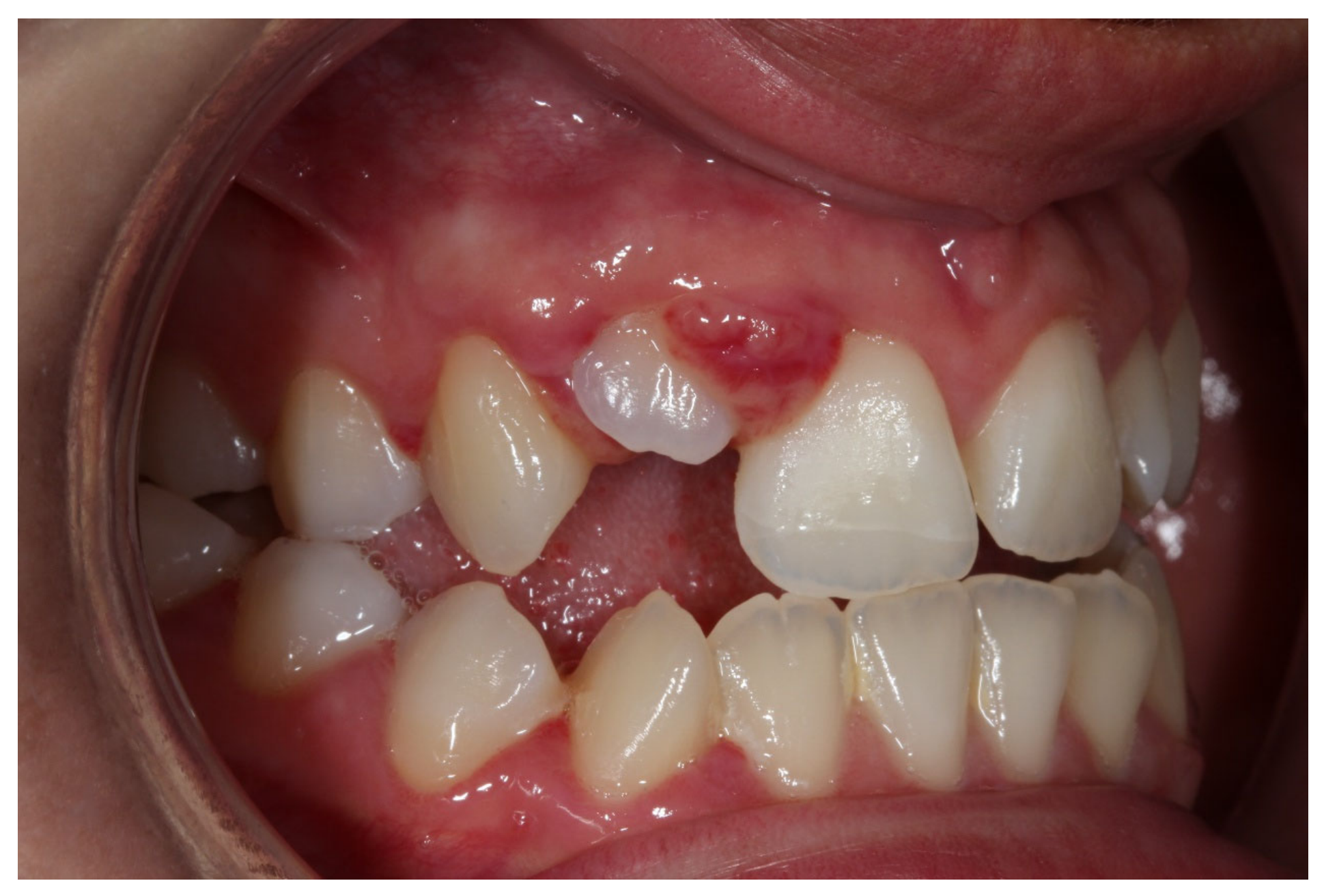 Dentistry 14 00288 g003 Dentistry 14 00288 g003