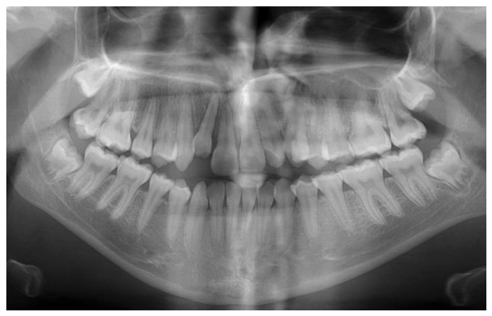 Dentistry 14 00288 g004 Dentistry 14 00288 g004