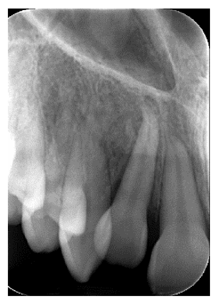 Dentistry 14 00288 g005 Dentistry 14 00288 g005
