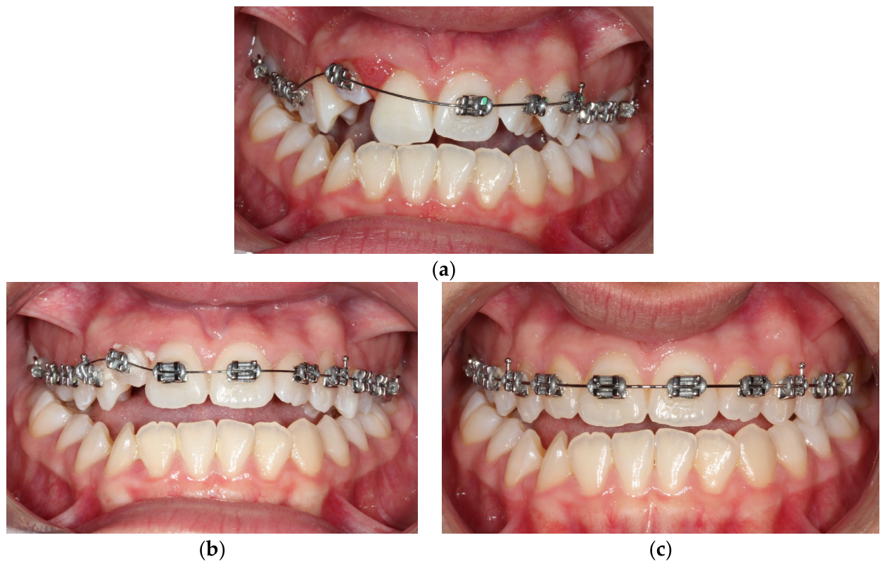 Dentistry 14 00288 g006 Dentistry 14 00288 g006