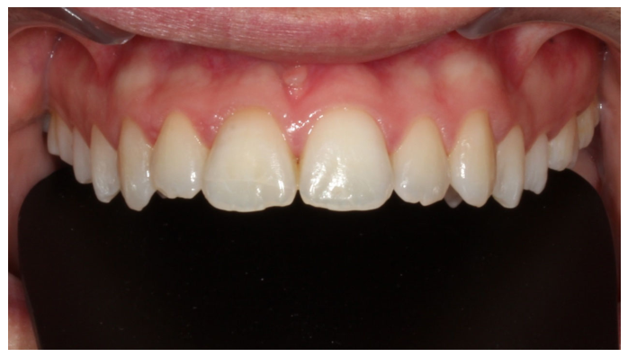 Dentistry 14 00288 g007 Dentistry 14 00288 g007