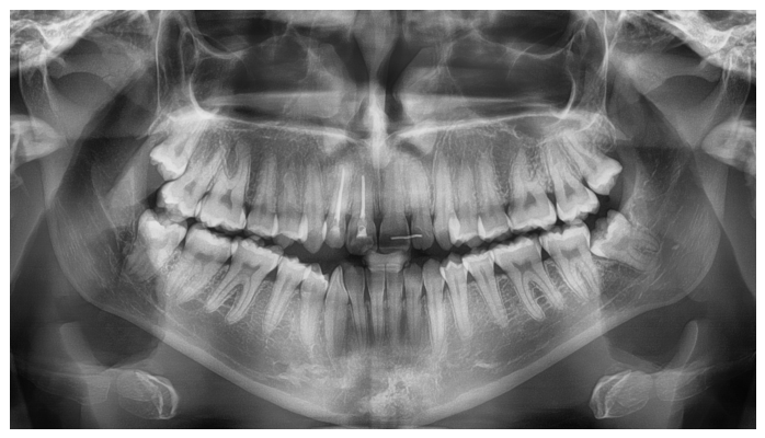 Dentistry 14 00288 g009 Dentistry 14 00288 g009