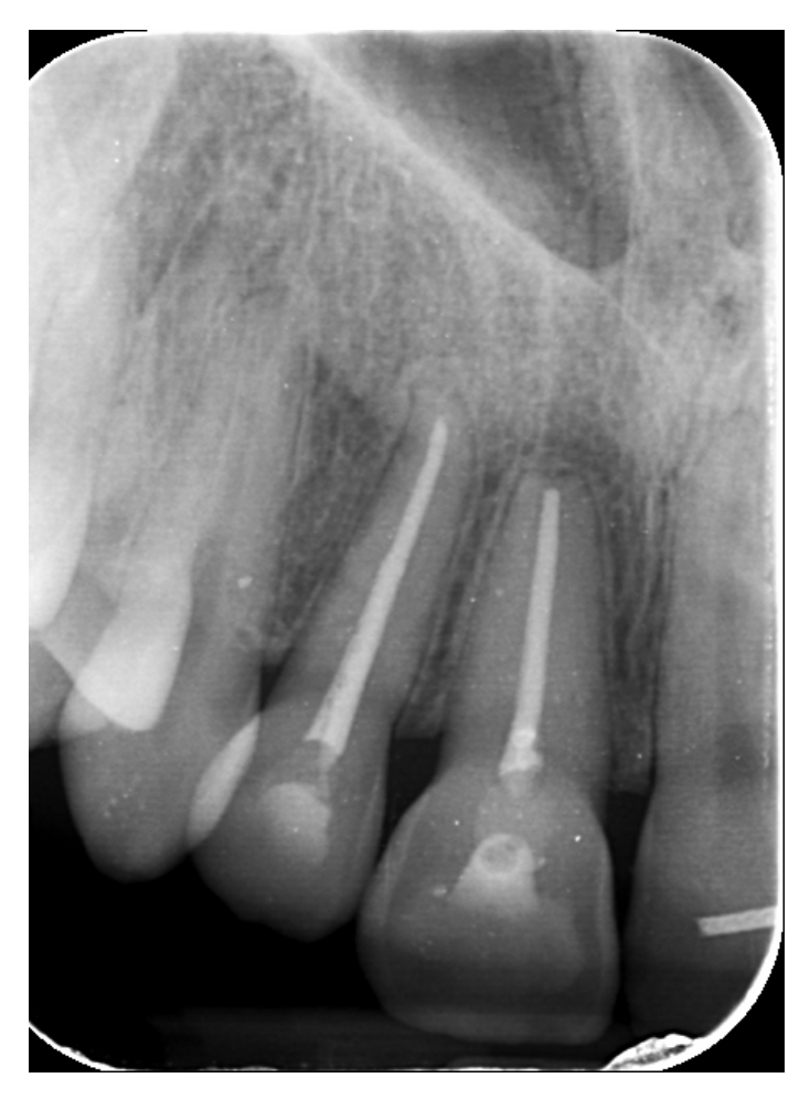 Dentistry 14 00288 g010 Dentistry 14 00288 g010