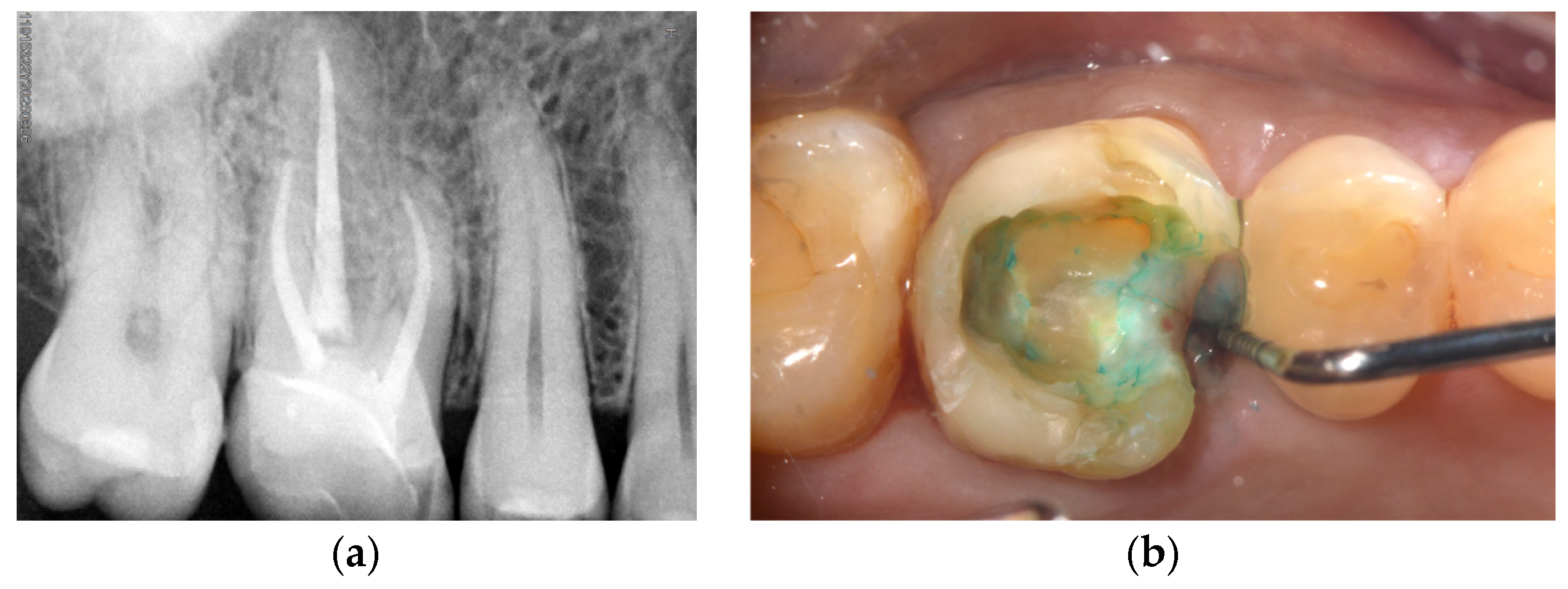 Dentistry 14 00347 g001