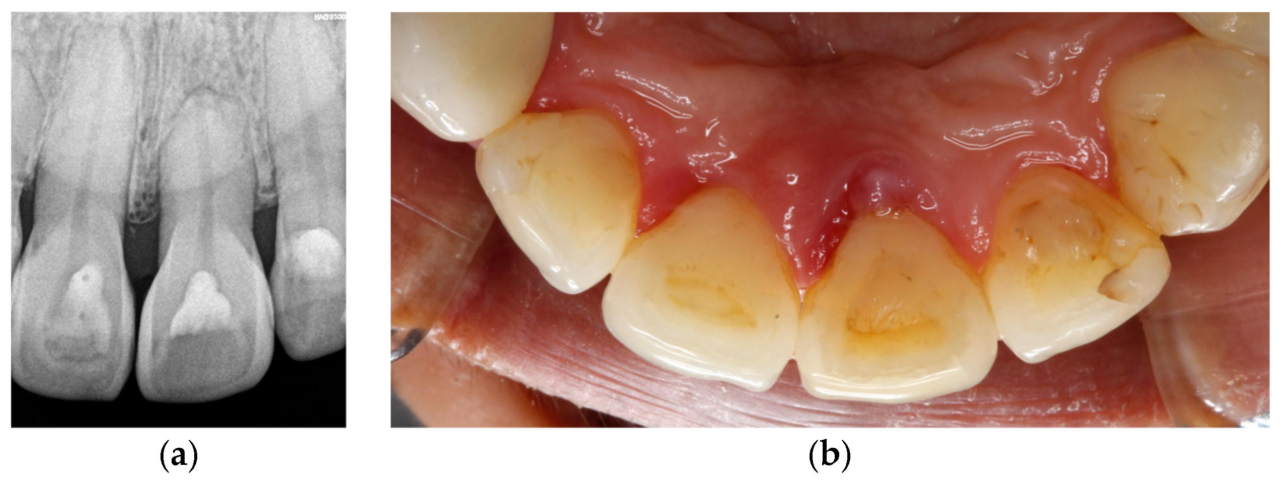 Dentistry 14 00347 g002