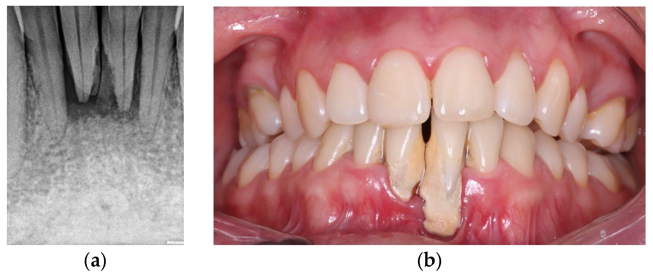 Dentistry 14 00347 g003
