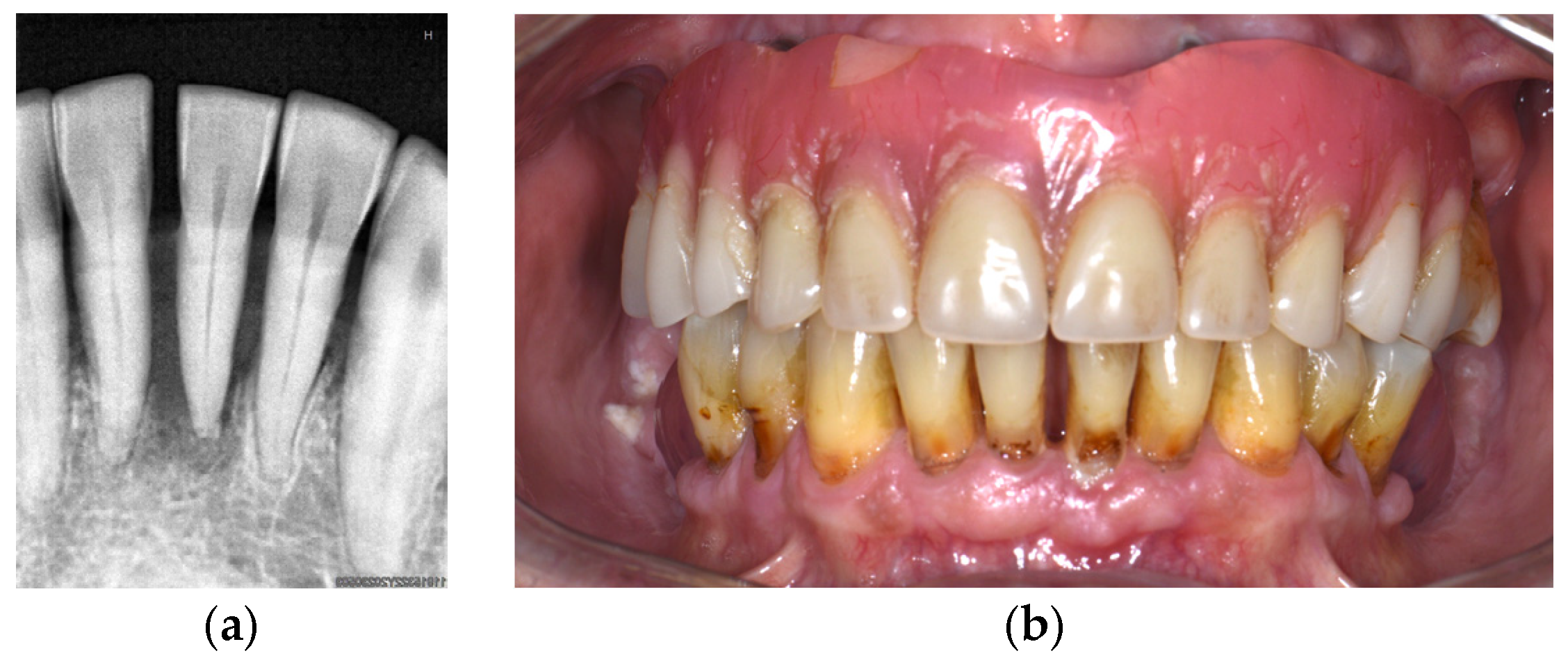 Dentistry 14 00347 g004