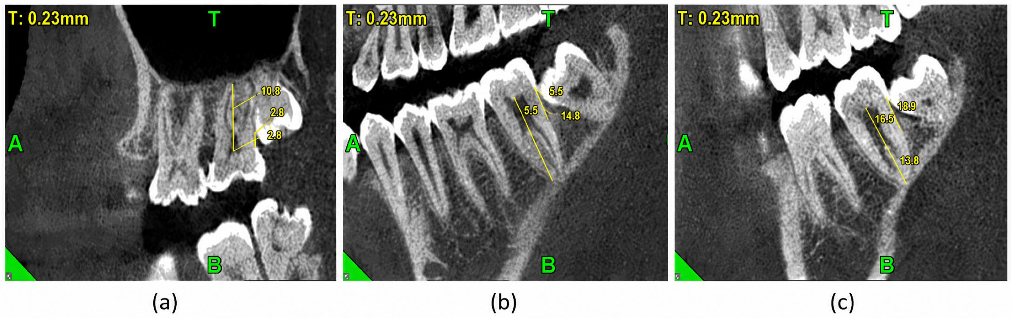 Dentistry 14 00357 g001