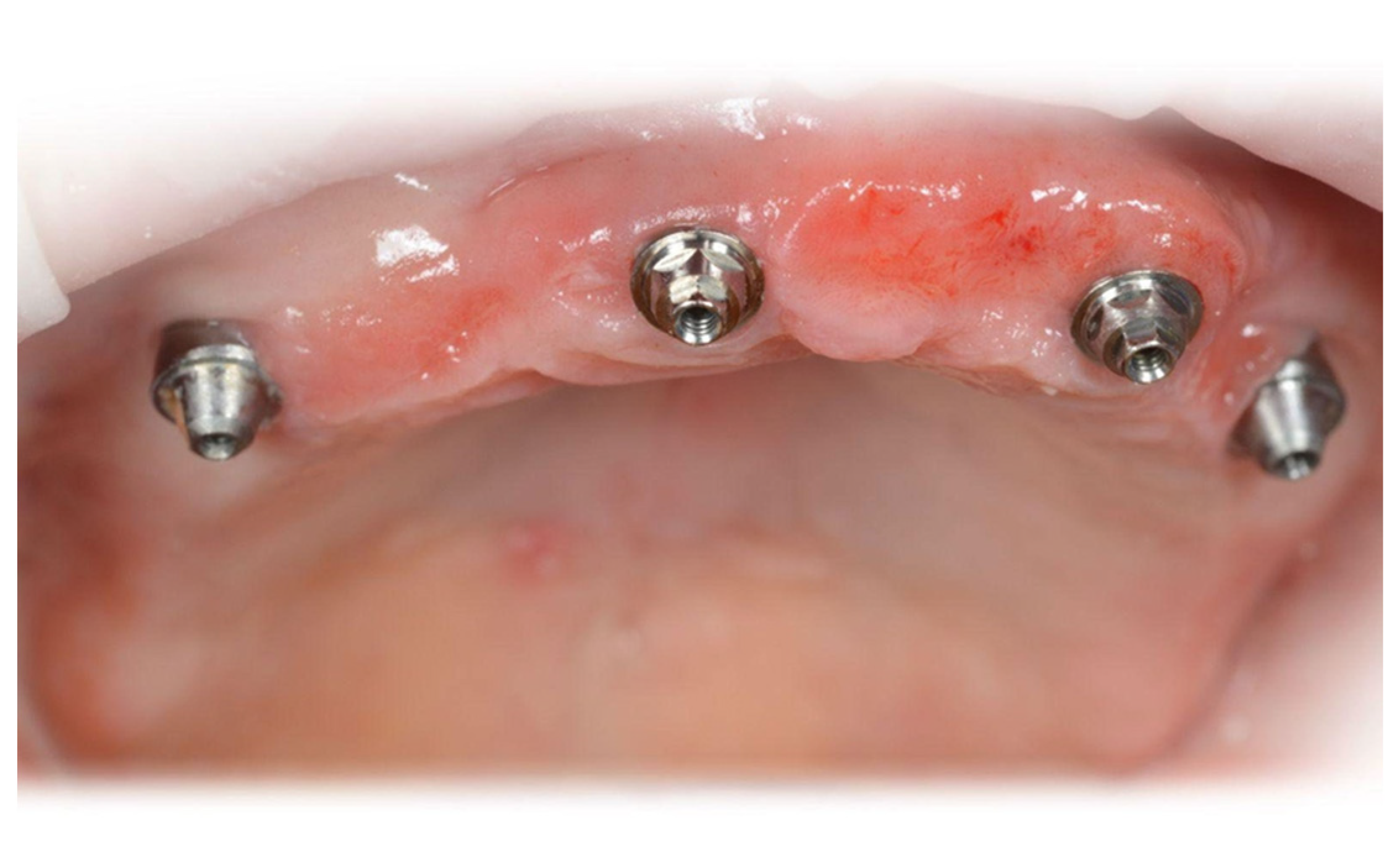 Dentistry 14 00358 g002 Dentistry 14 00358 g002