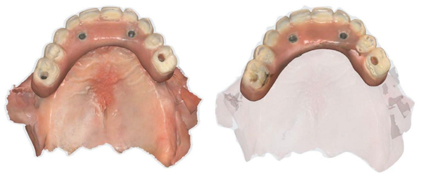 Dentistry 14 00358 g003 Dentistry 14 00358 g003