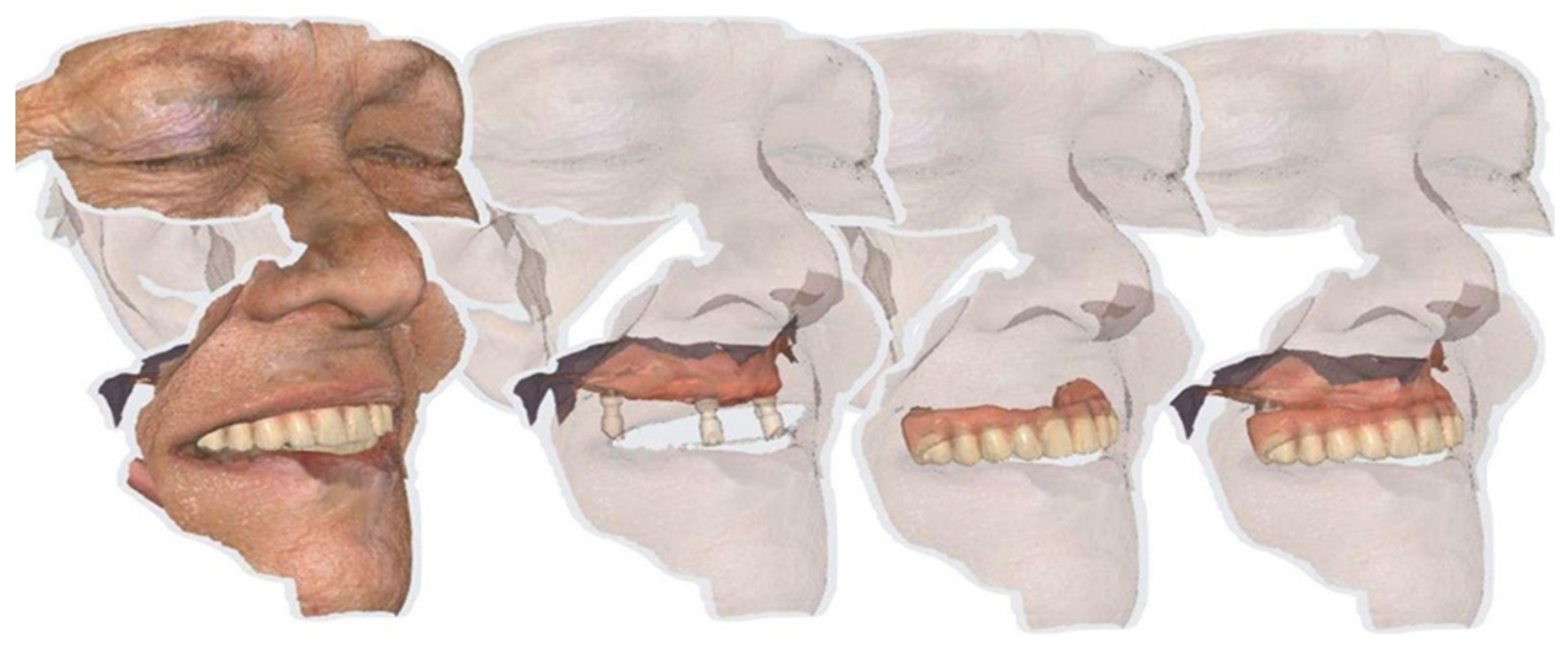 Dentistry 14 00358 g004 Dentistry 14 00358 g004