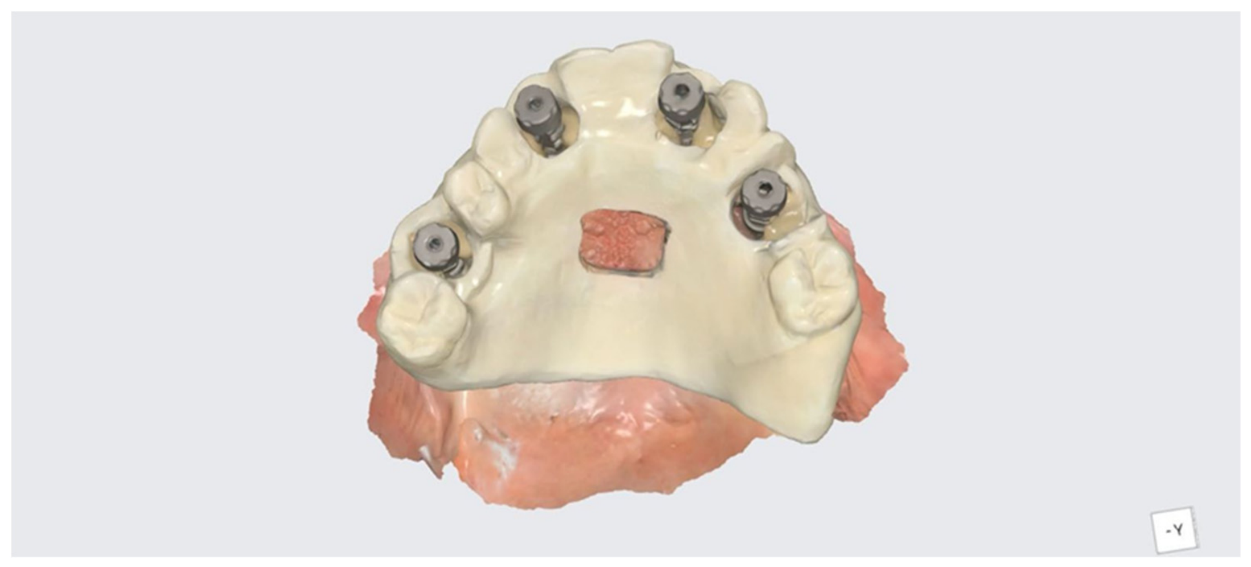 Dentistry 14 00358 g005 Dentistry 14 00358 g005