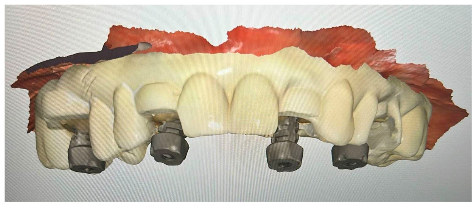 Dentistry 14 00358 g009 Dentistry 14 00358 g009