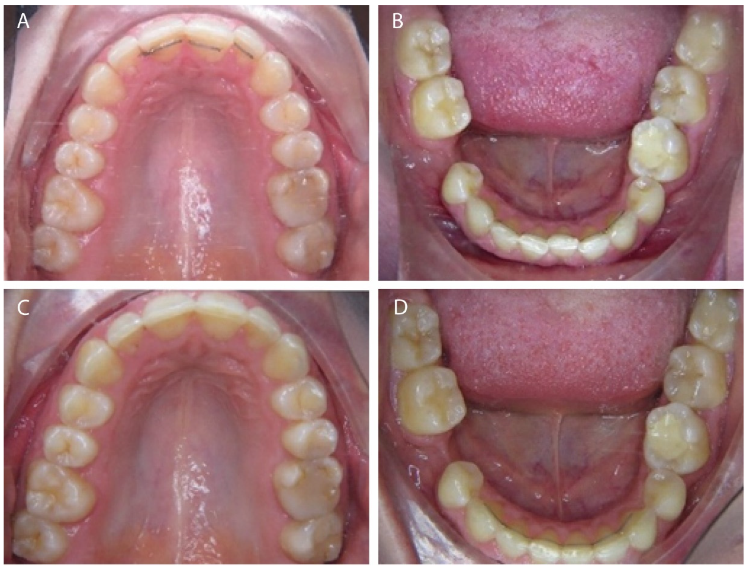 Dentistry 14 00370 g001 Dentistry 14 00370 g001