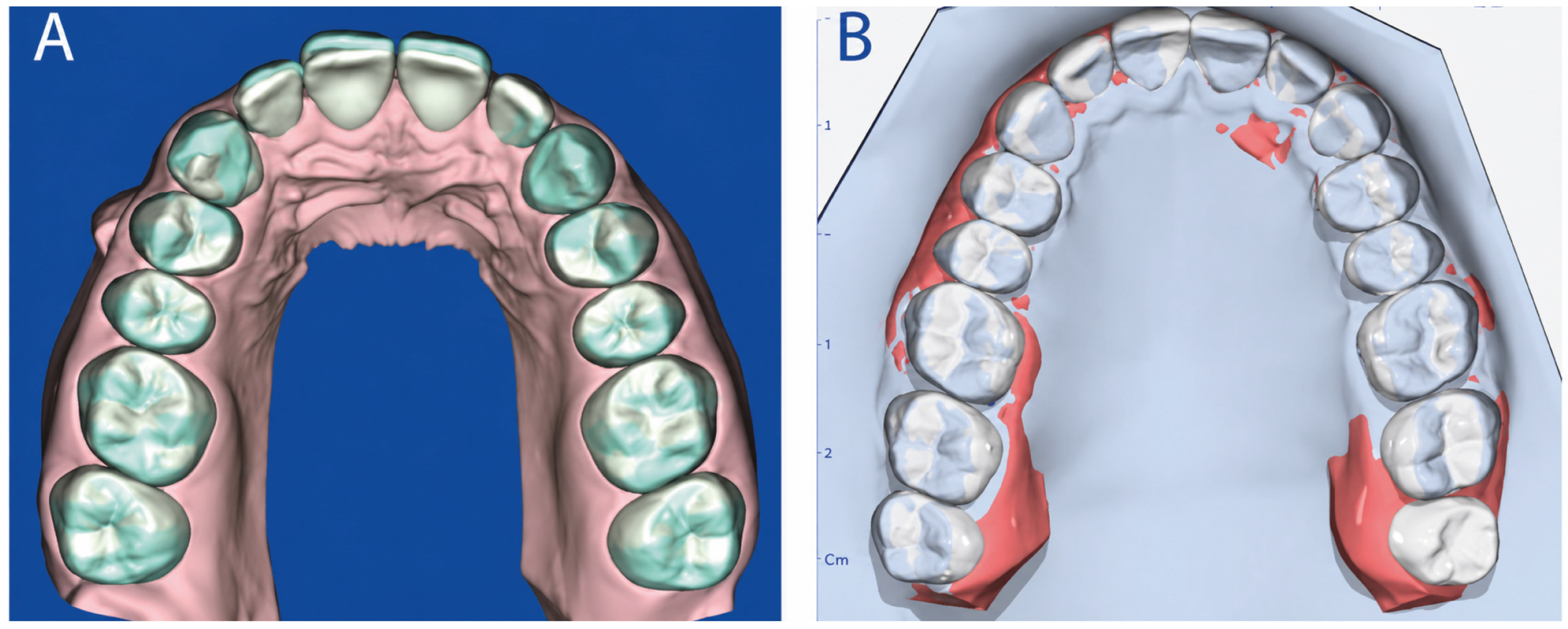 Dentistry 14 00370 g003 Dentistry 14 00370 g003
