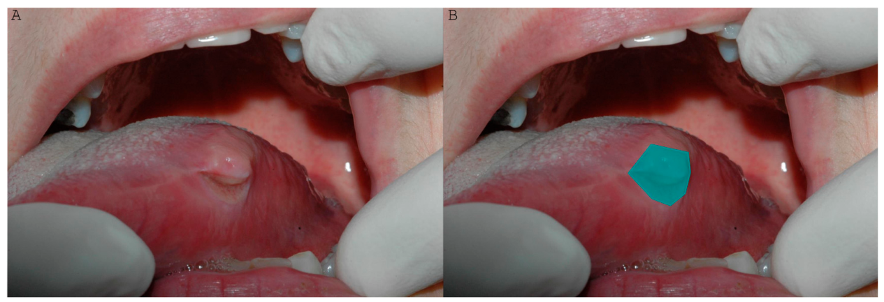 Dentistry 14 00429 g001 Dentistry 14 00429 g001