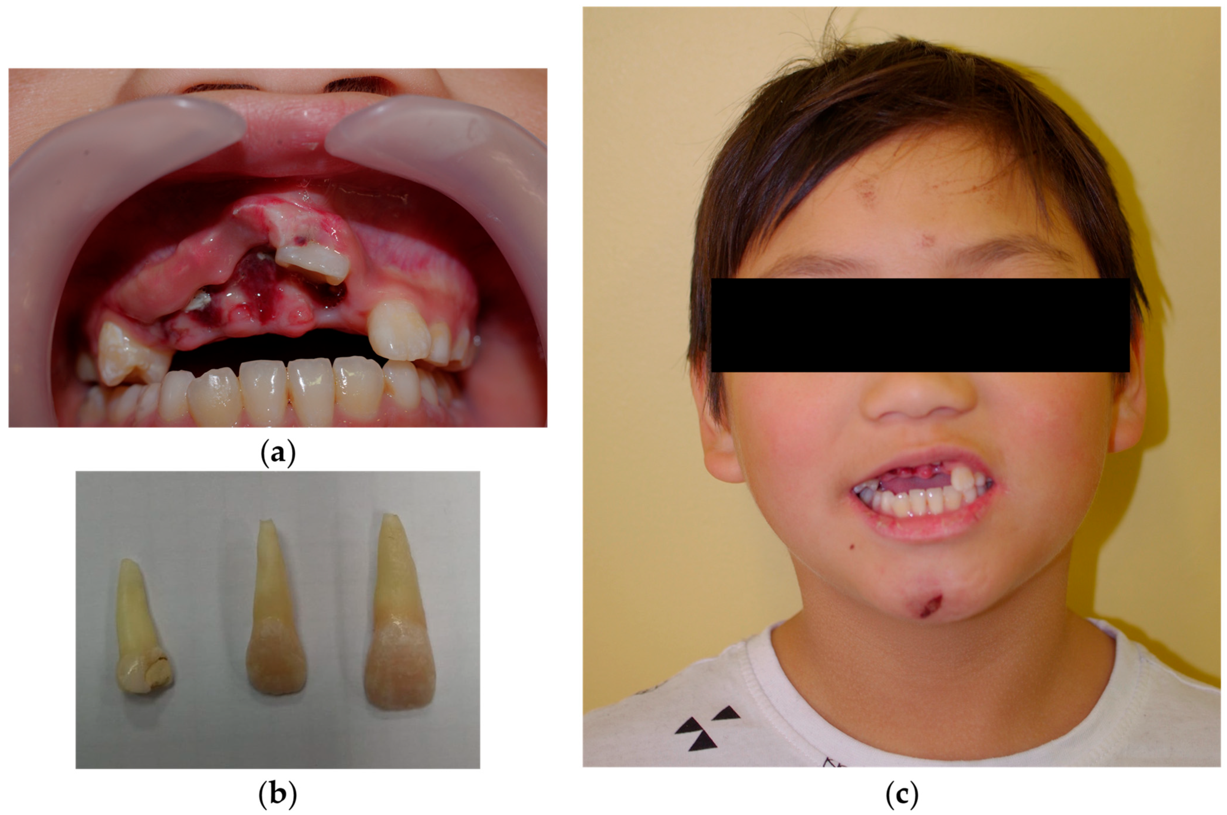 Dentistry 14 00435 g002 Dentistry 14 00435 g002