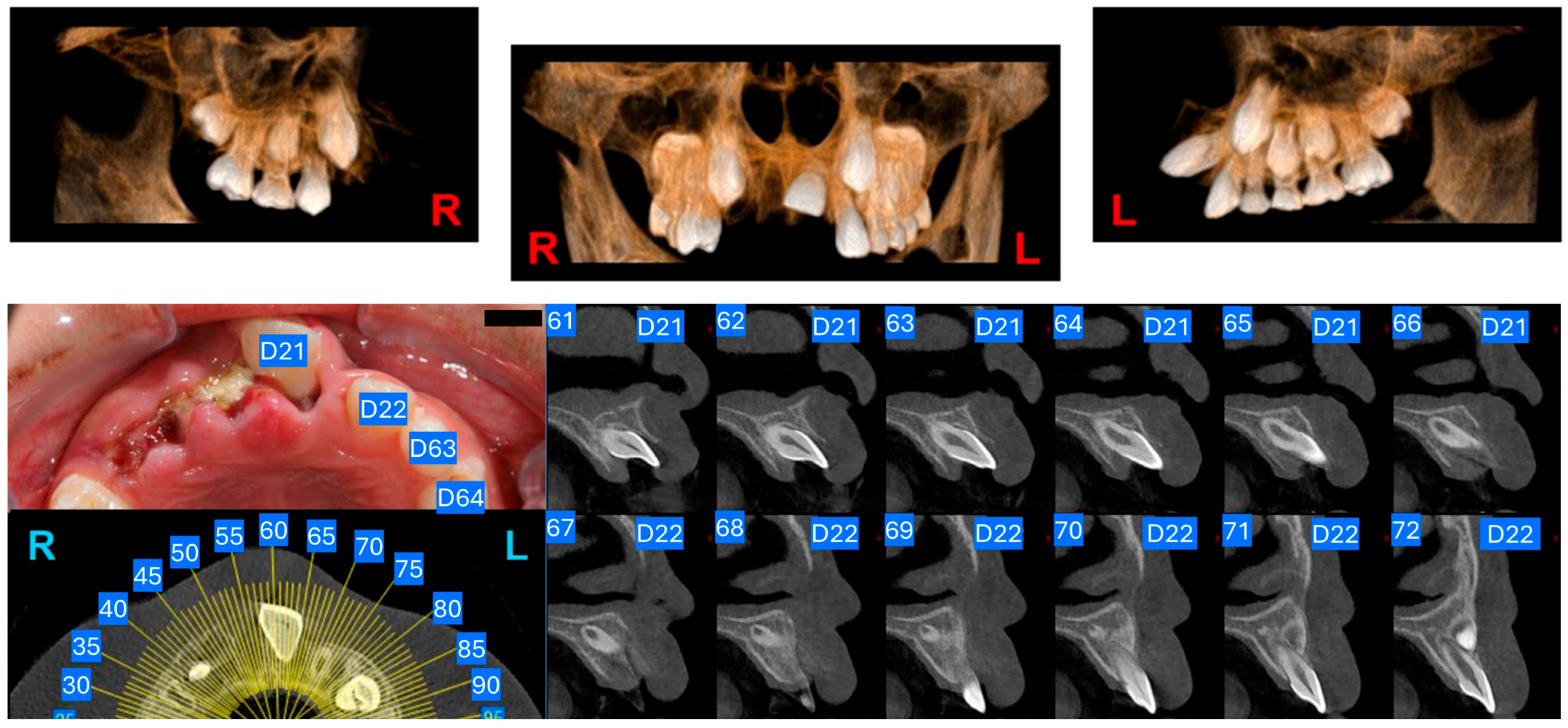 Dentistry 14 00435 g003 Dentistry 14 00435 g003